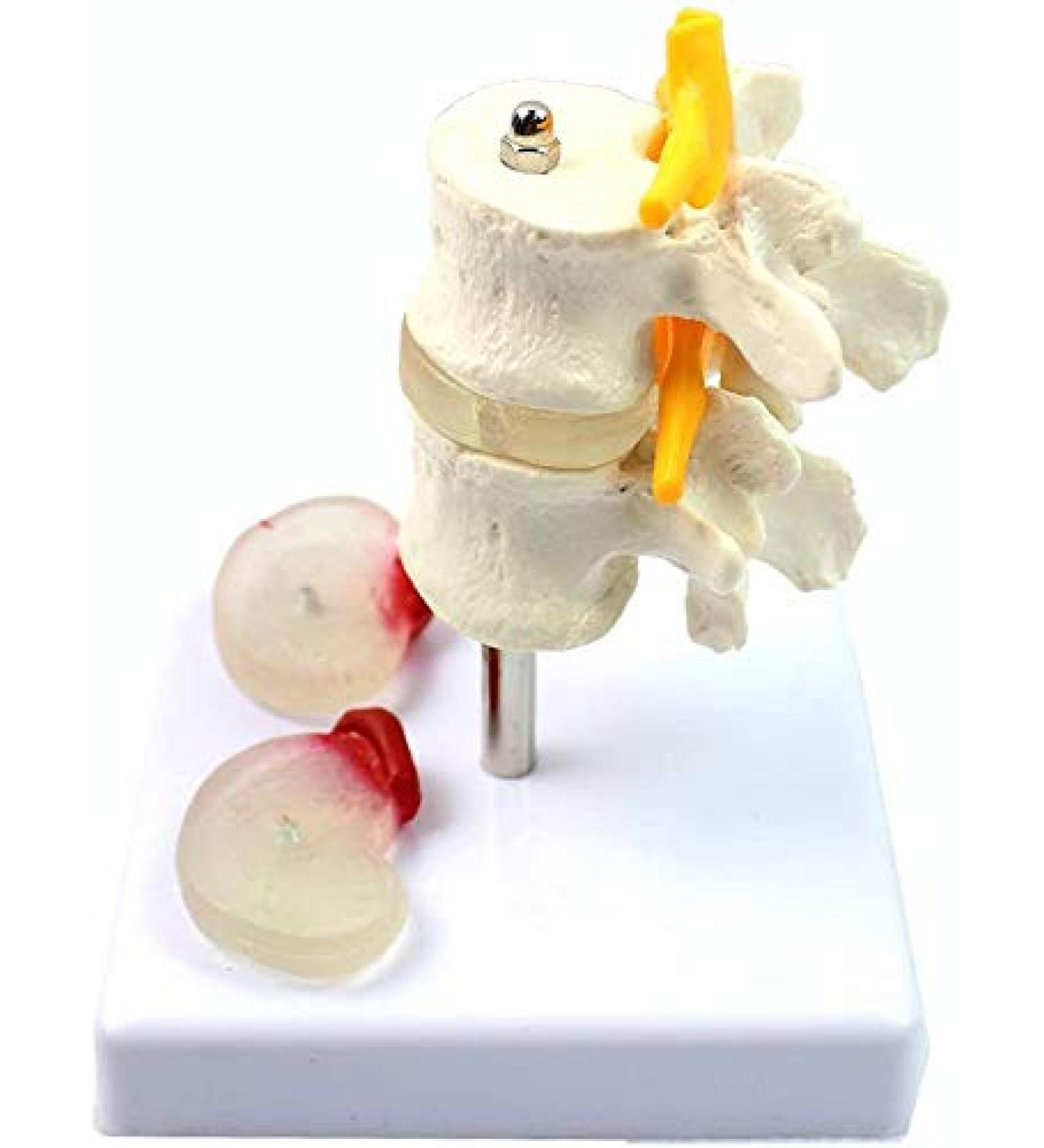 Model of Human Spine Detachable Medical Teaching Model Lumbar Spine Injuries with 2 Intervertebral Disc Model Model - Buy Online on SooperMarket.com