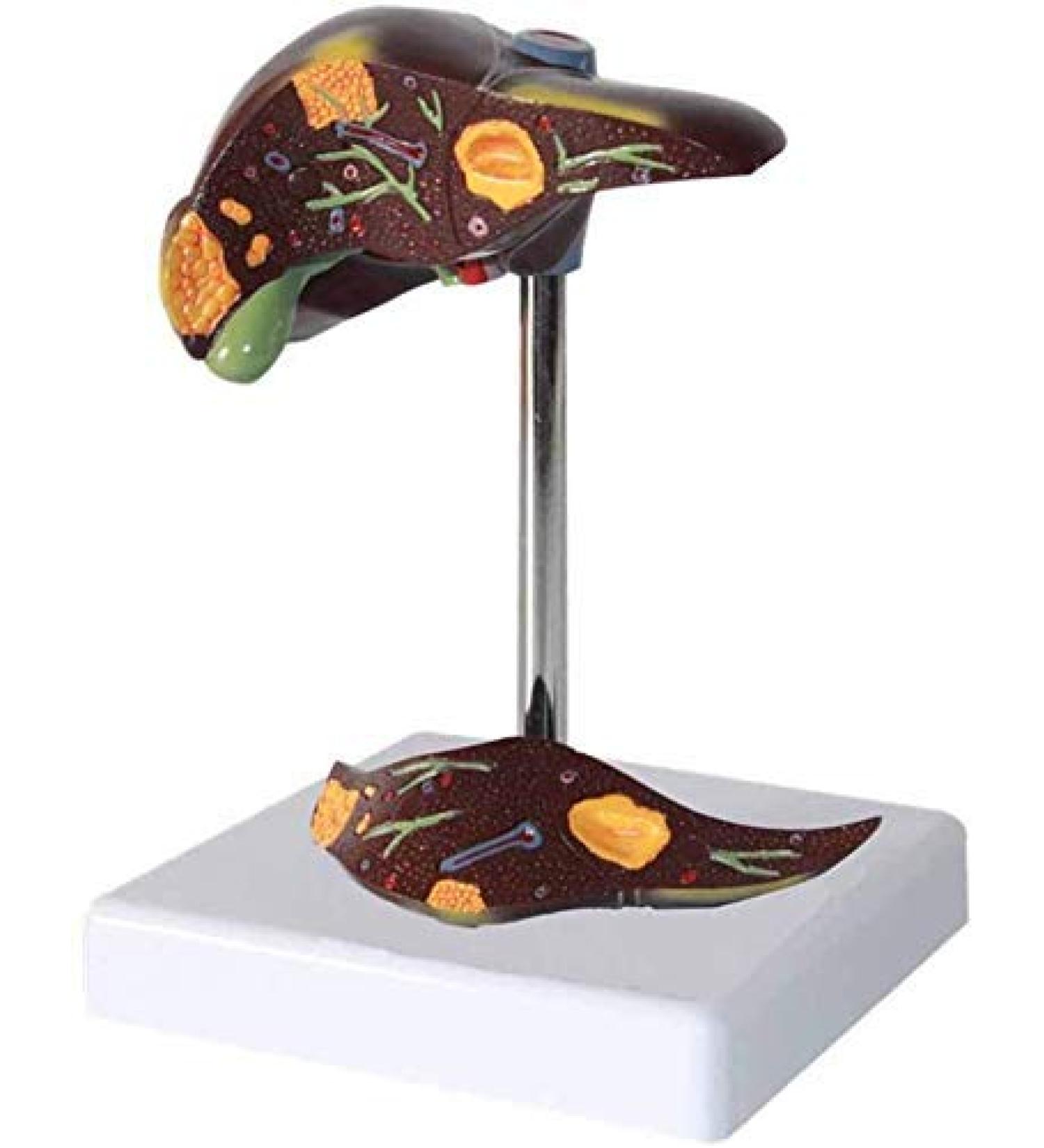 Human Liver Pathological Model with Base On Support Tool Study On Medical Model Internal - Buy Online on SooperMarket.com