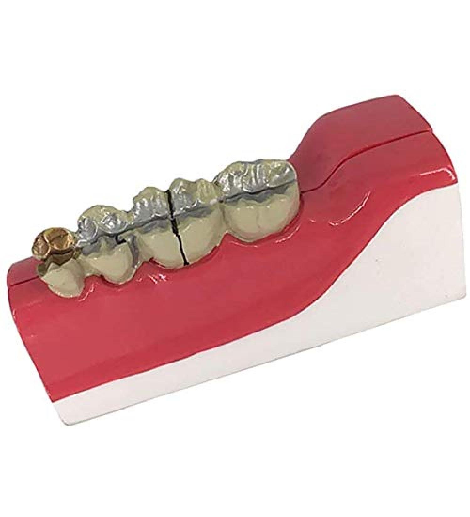 Buy LBYLYH Teeth Adult Replica Model - Realistic Dental Teaching Tool | Removable Tissues for Education & Practice - Buy Online on SooperMarket.com