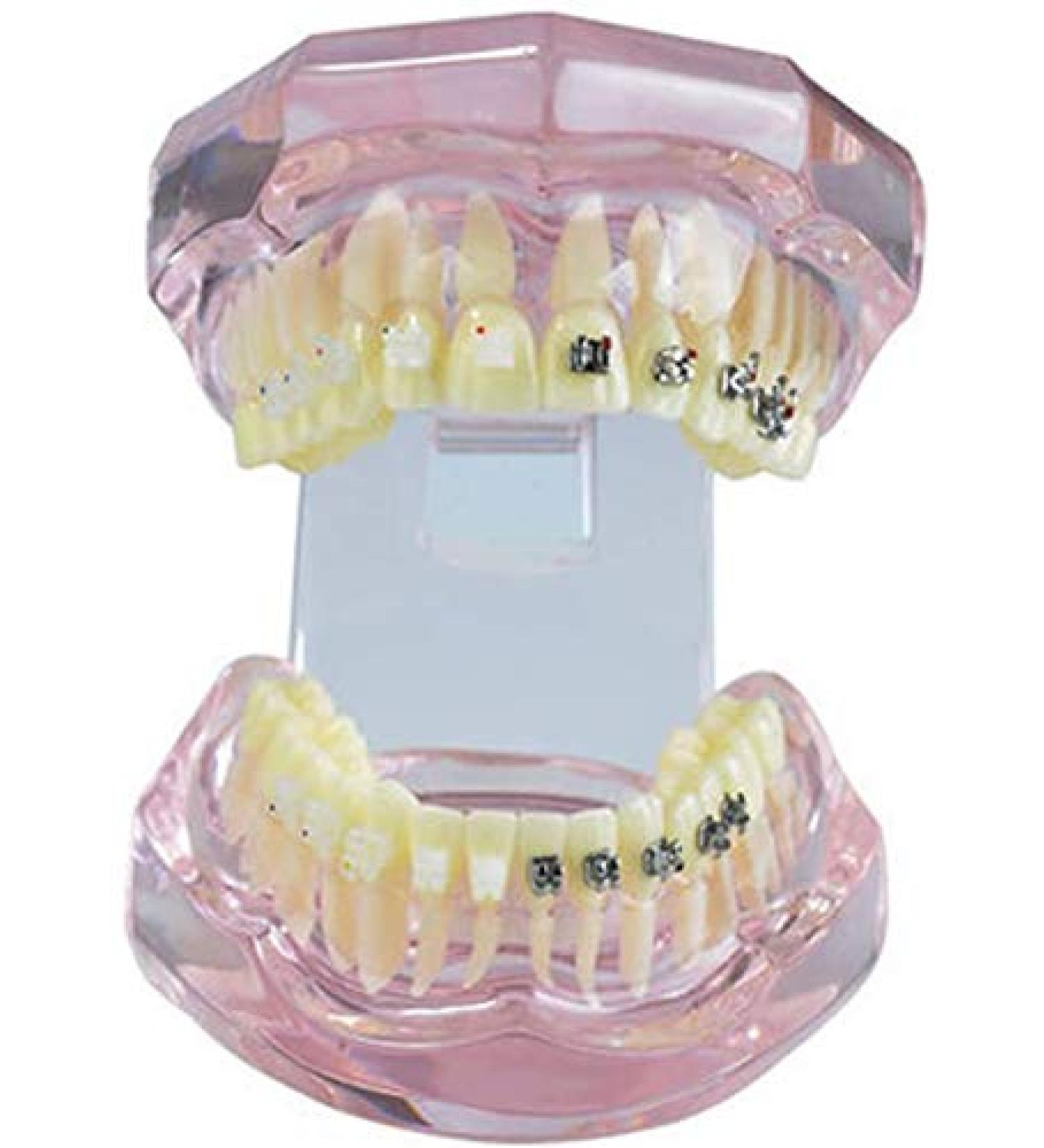 LBYLYH Pink Teeth Model - Orthodontic Dental Studio Educational Toy for Kids - Buy Online on SooperMarket.com