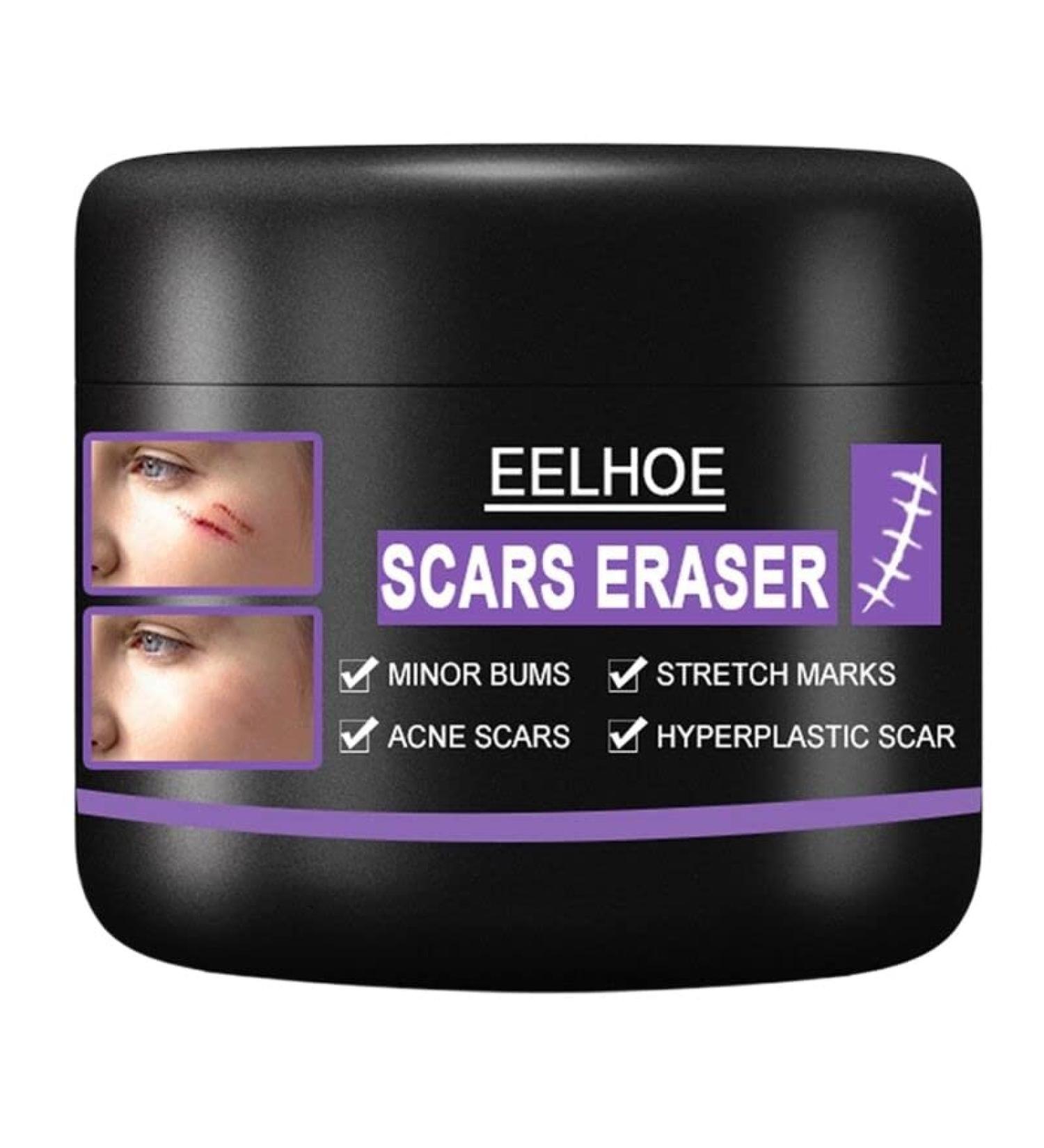 Scar Repair Cream | Acne Scar Removal | Pigmentation Corrector - 10/30/50g - Buy Online on SooperMarket.com