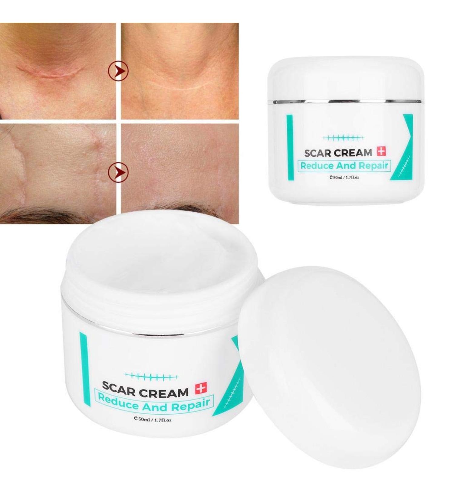 Scar Removal Cream | Stretch Marks Serum | Skin Repair Treatment - Buy Online on SooperMarket.com