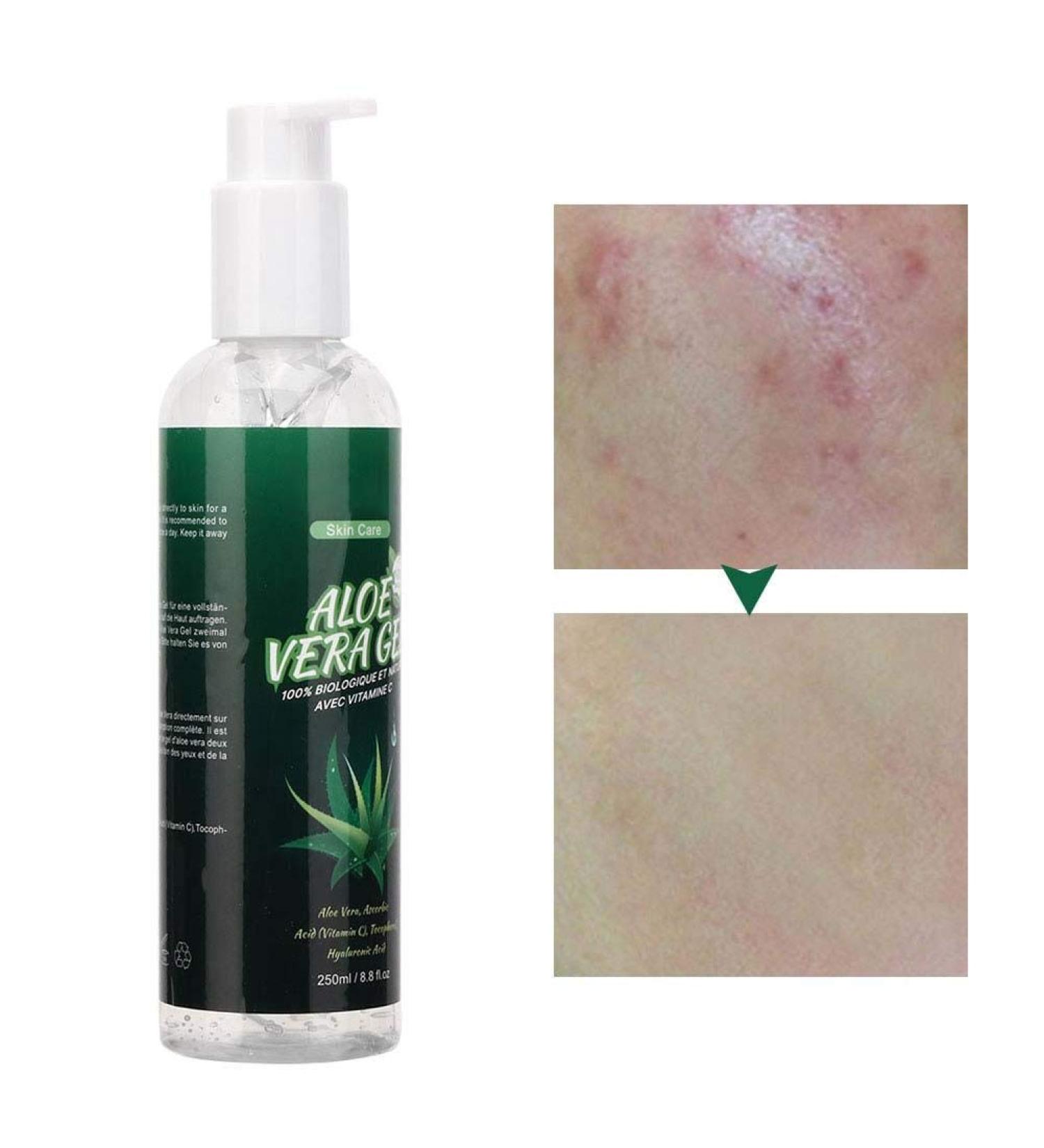 250ml Aloe Vera Gel Moisturizing and Anti wrinkle Cream Repair of Whitening Scar Sunscreen Aloe Gel Soothing and Moisturizing Facial Skin for face body sunburn and Dry - Buy Online on SooperMarket.com