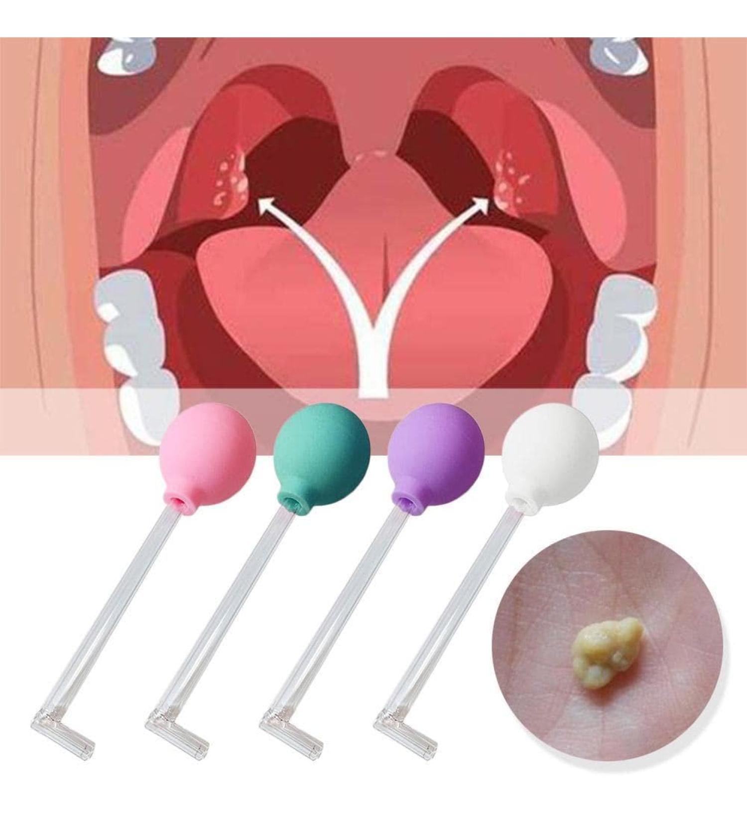 Tonsil Stone Remover Tool - Manual Style Mouth Care Tool for Ear Health - 1pcs - Buy Online on SooperMarket.com