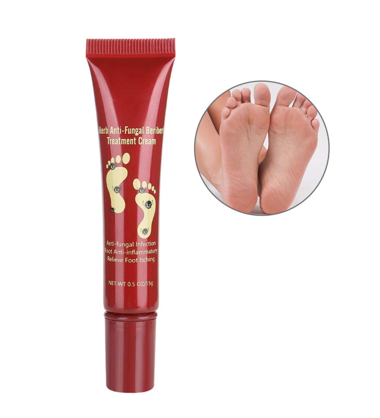 Crema para el Tratamiento de los Pies 15g | Hidratante Natural para Aliviar Hongos y Picaz n | Cuidado Efectivo para Plantas - Buy Online on SooperMarket.com