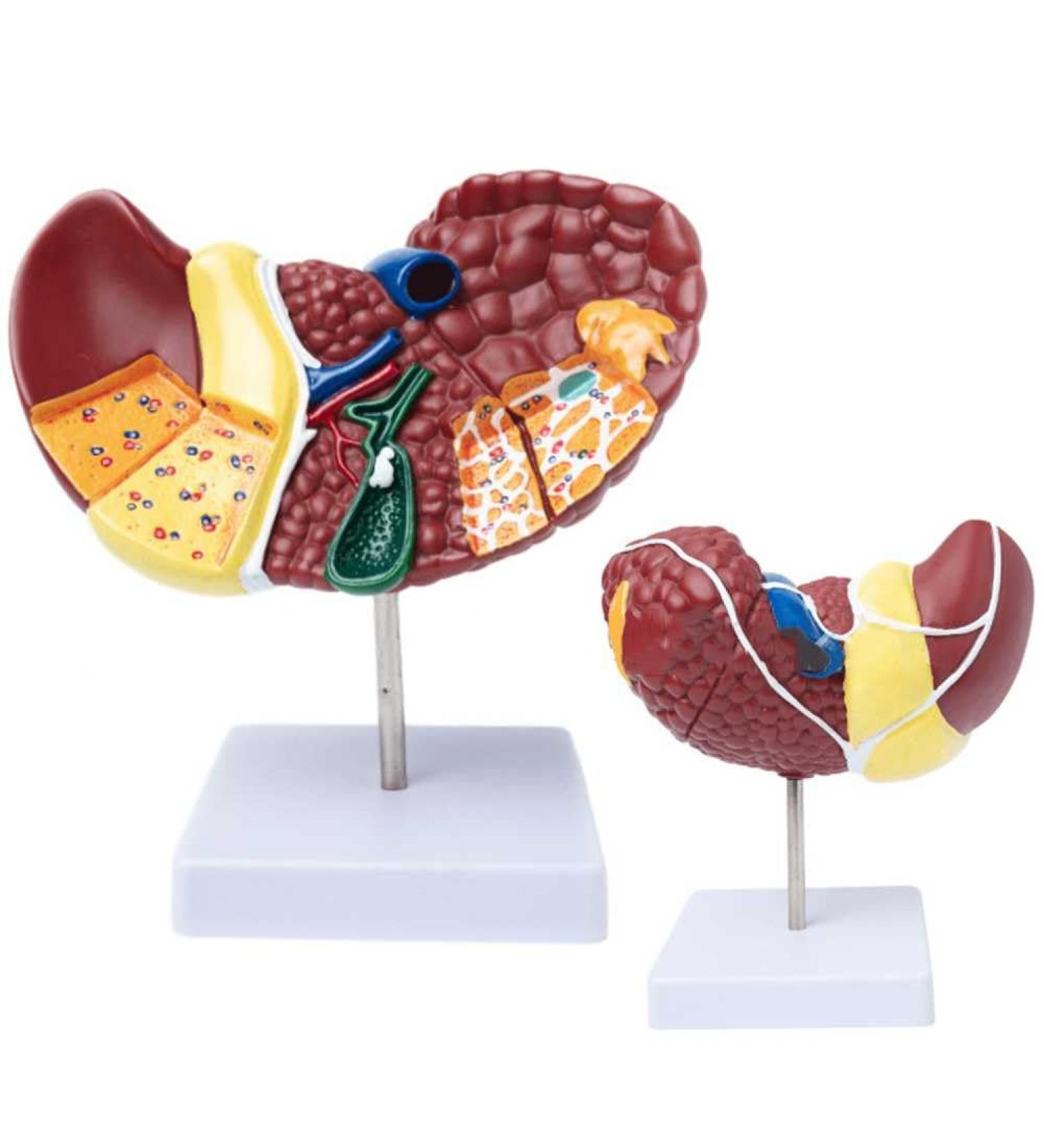 Teaching Model Human Liver Educational Model with Base and Clear Texture and Pathological Features Liver Cirrhosis Model for Medical School Study and Research - Buy Online on SooperMarket.com