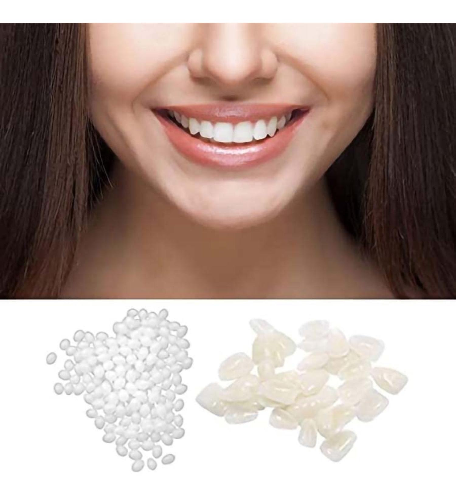 ChezMax Temporary Tooth Repair Kit - Fix Missing & Broken Teeth - Natural Solution - Buy Online on SooperMarket.com