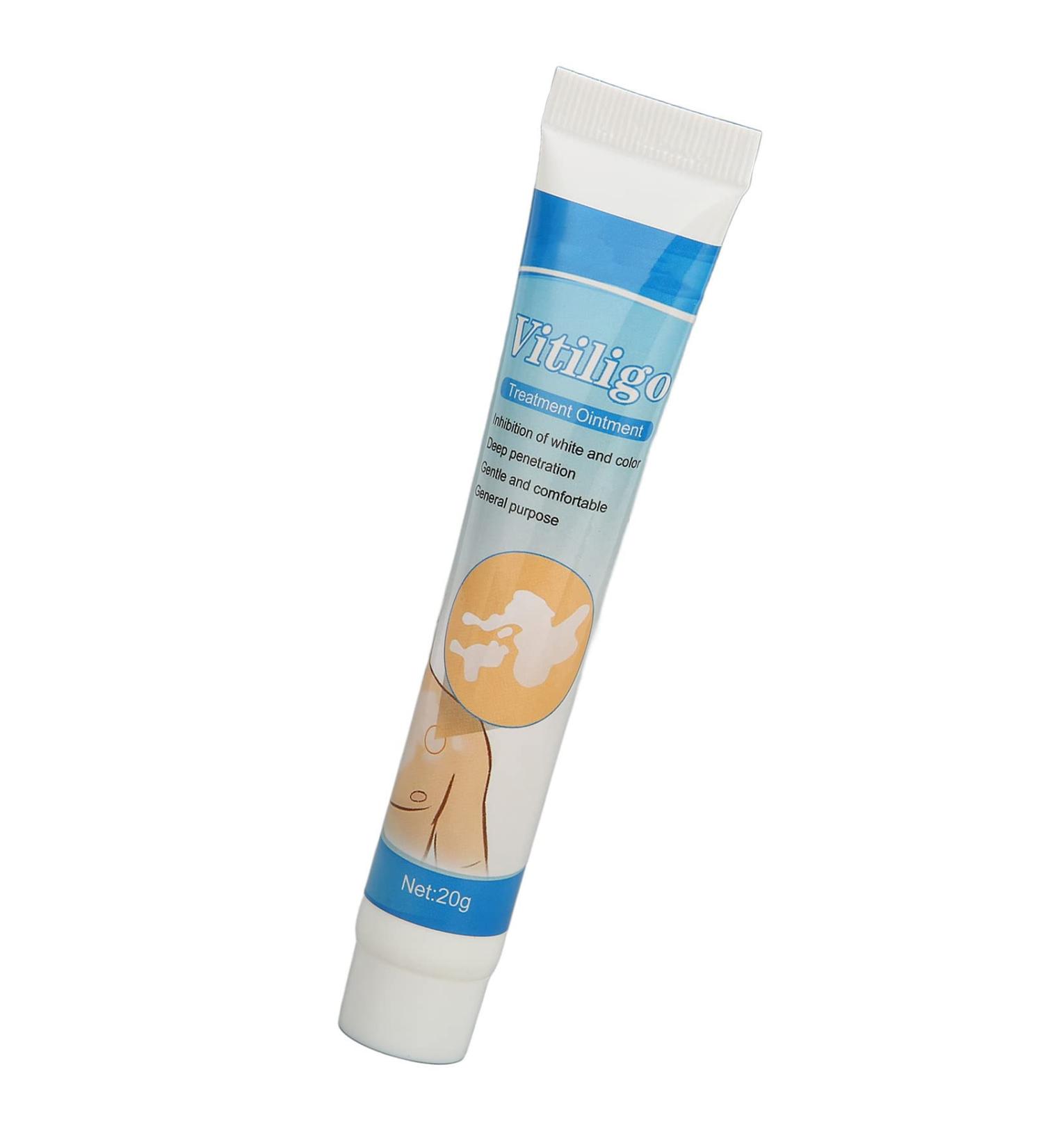 Vitiligo Cream 30G - Herbal Extract Treatment for White Spots & Skin Pigmentation - Creme Medix Leukoplakia Solution - 0.7oz - Buy Online on SooperMarket.com