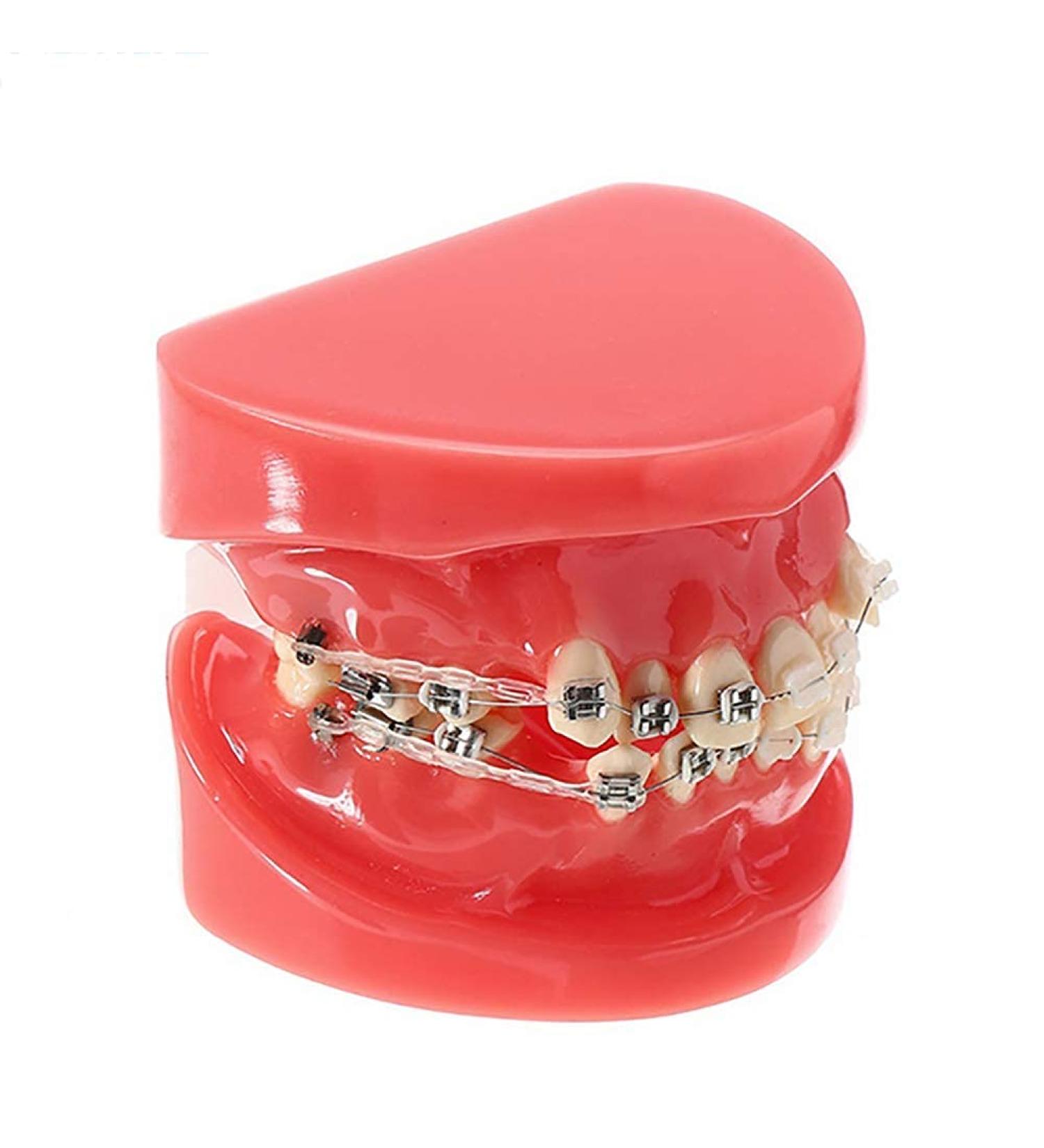 Orthodontic Braces Model Doll-10 - Ceramic Teeth Study for Adults | Ideal for Medical Science & Teaching Research - Buy Online on SooperMarket.com