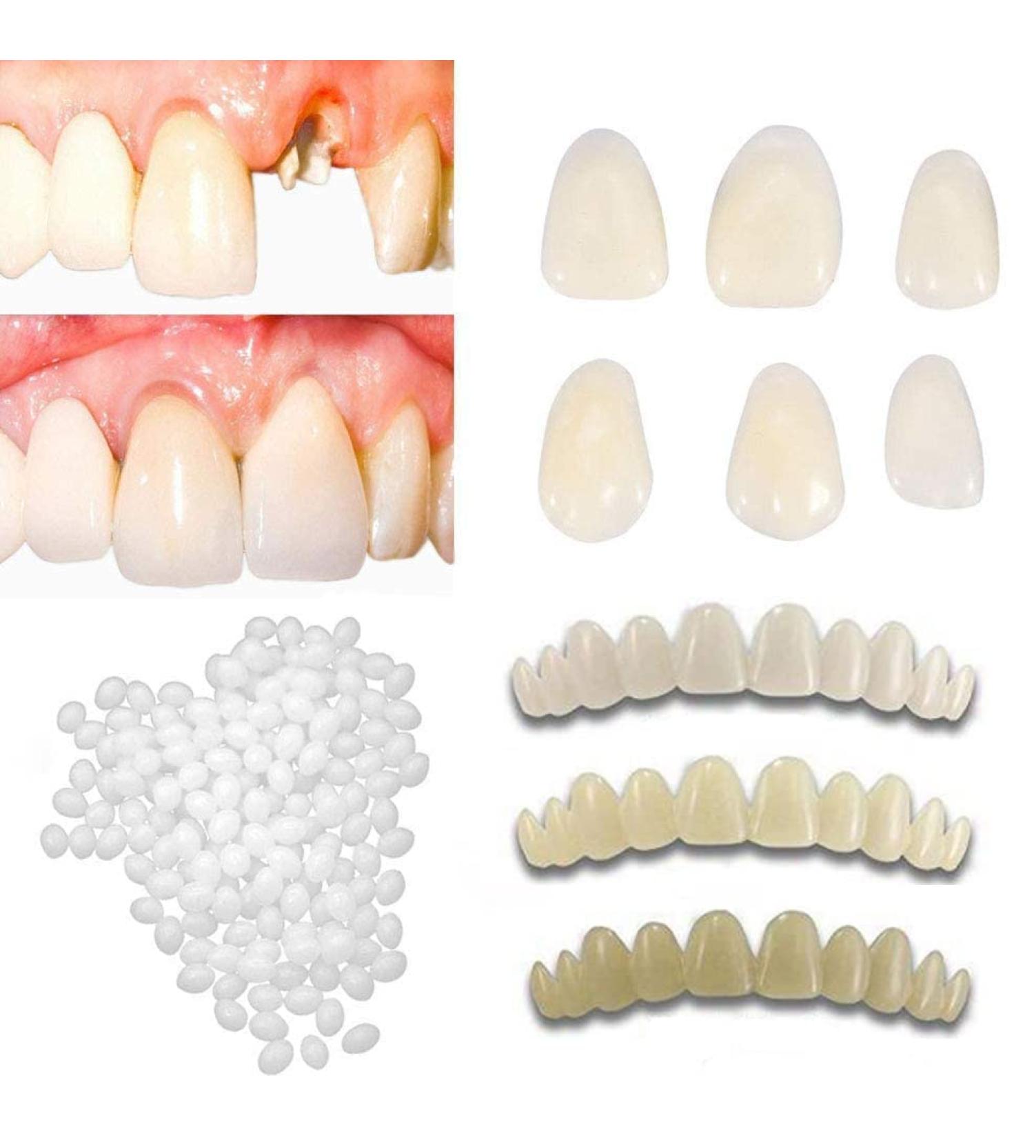 Snap on Smile Braces Instant Perfect Smile Temporary Replacement Tooth Kit for Broken Missing Teeth - Buy Online on SooperMarket.com