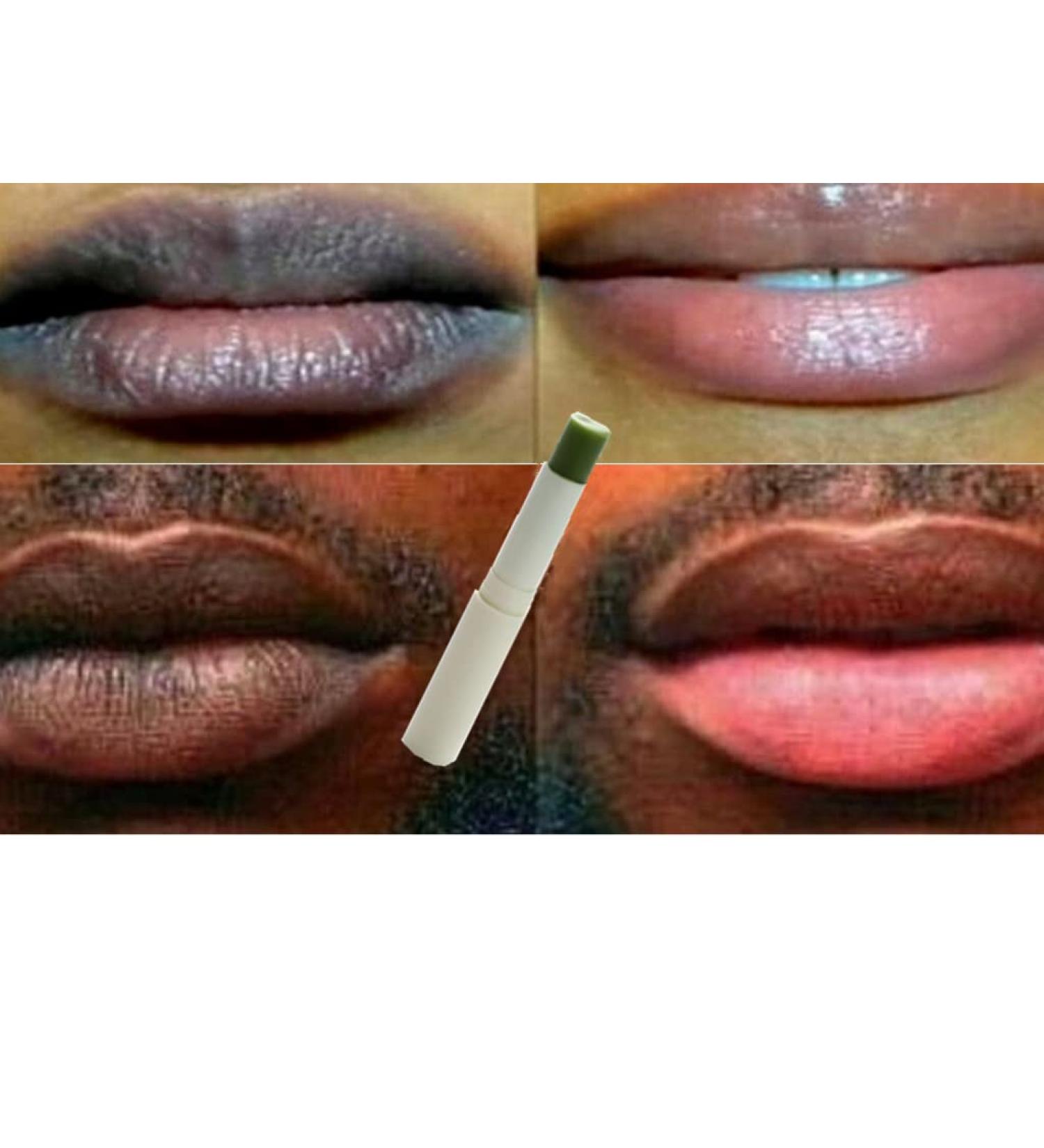 Pink Fresh Lightening Cream & Blackish Green Balm Set for Dark Lip Removal - 2PC Treatment - Buy Online on SooperMarket.com