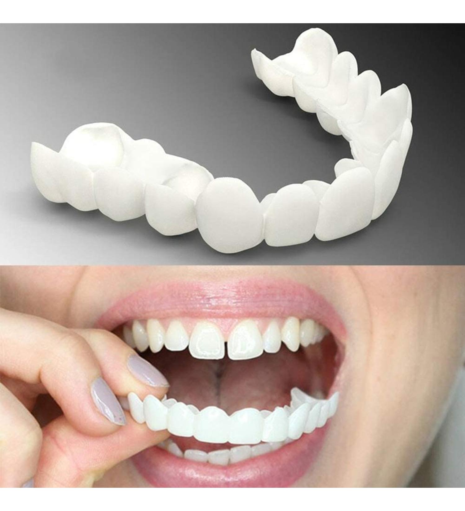 Buy False Teeth & Cosmetic Veneers - Temporary Braces for Perfect Smile | Ship Internationally - Buy Online on SooperMarket.com