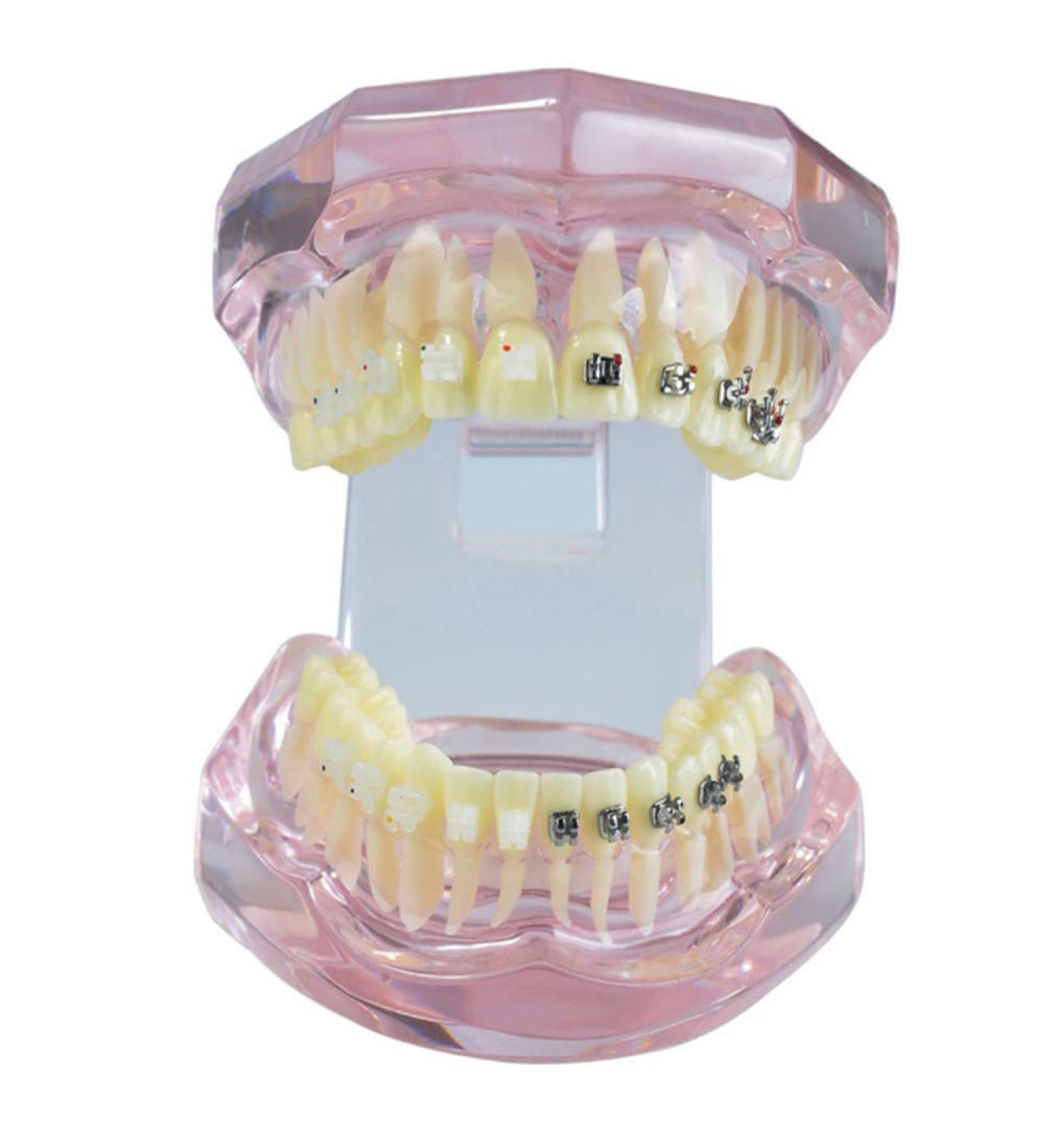 LBYLYH Orthodontic Demonstration Model - Teeth Teaching Tools with Metal & Ceramic Support for Effective Dental Treatment - Buy Online on SooperMarket.com