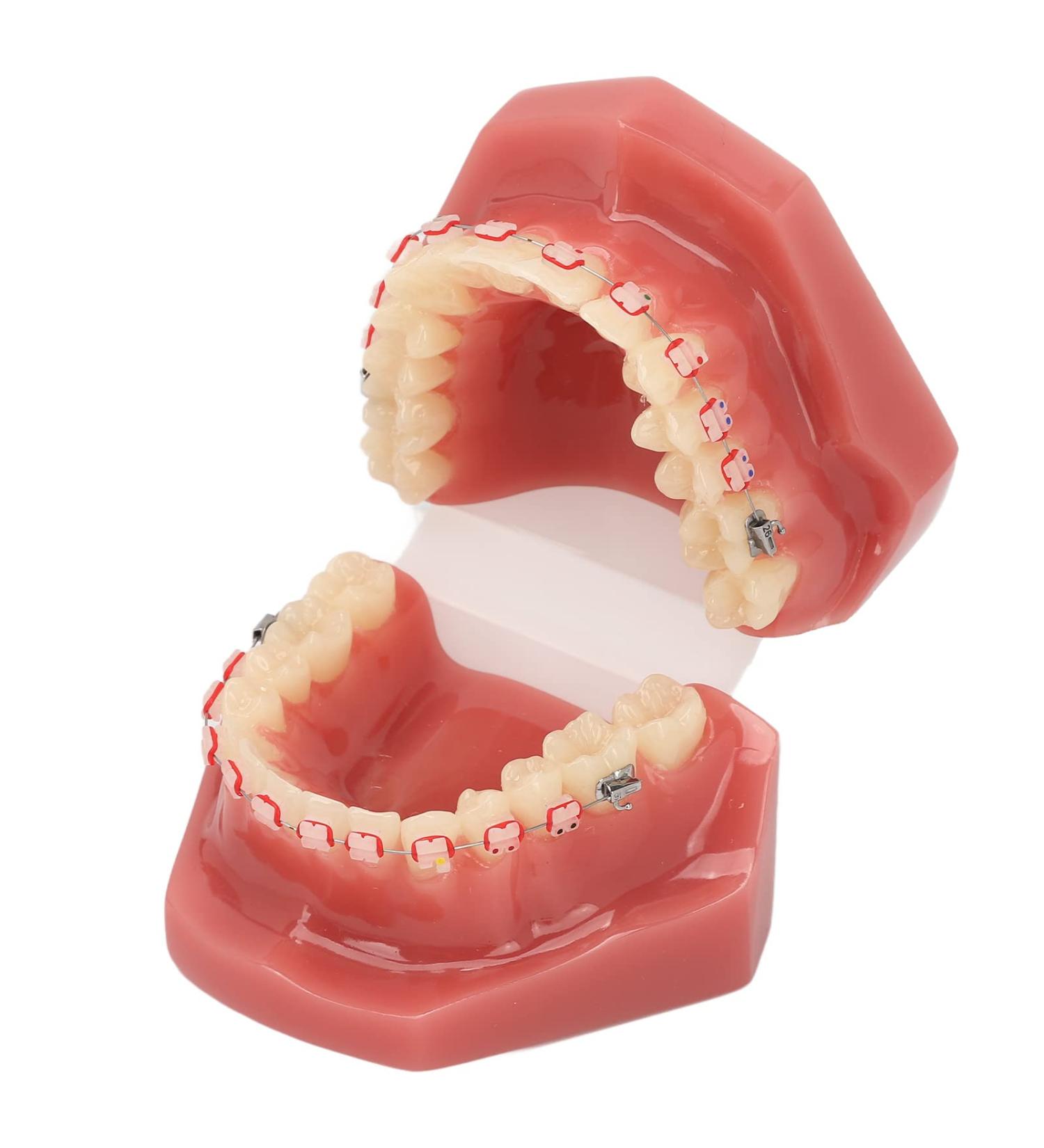 Orthodontic Demonstration Model for Dental Research | Metal Wires & Ceramic Brackets | Teaching Aids for Adults - Buy Internationally - Buy Online on SooperMarket.com
