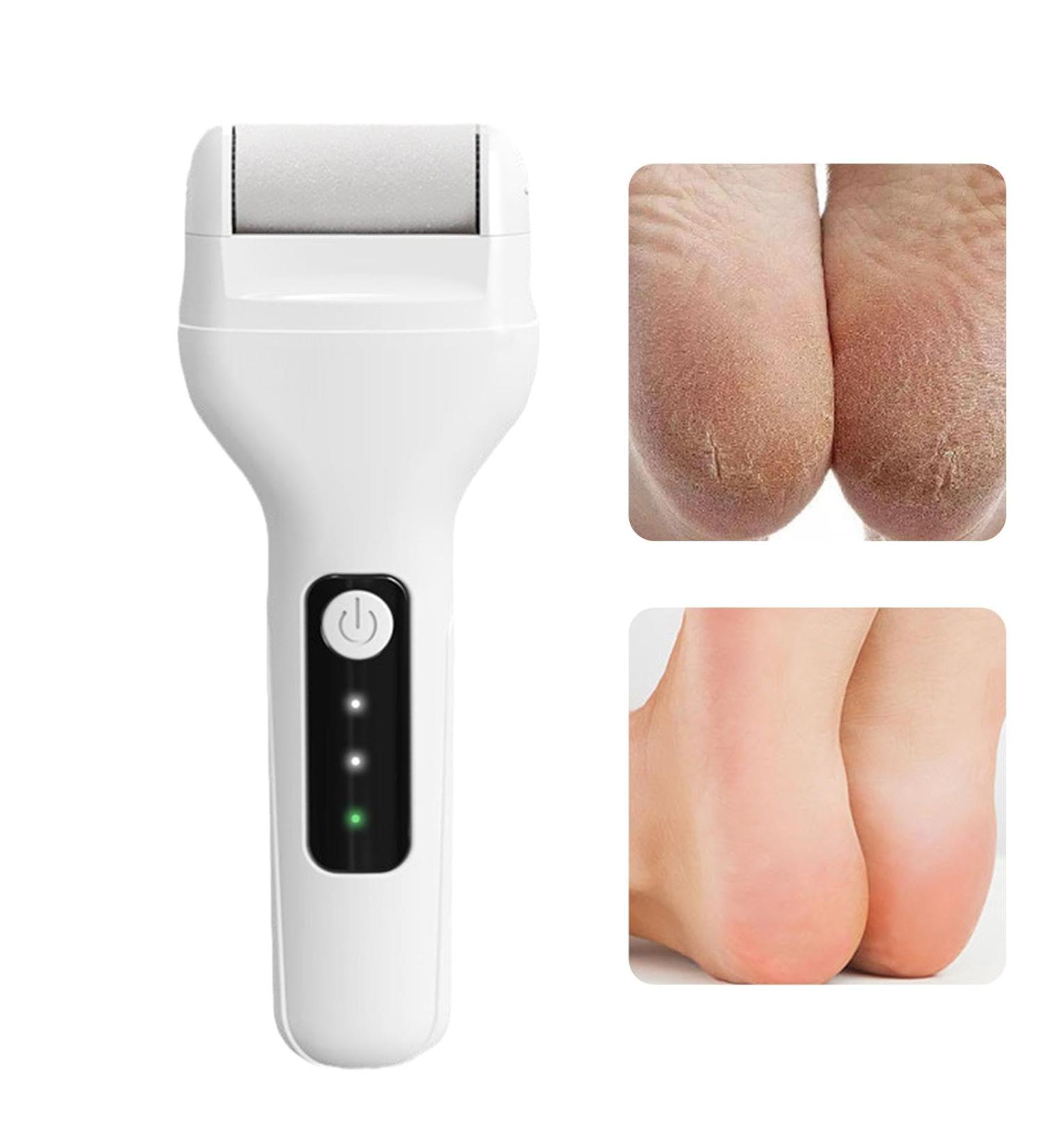 Teksome Electric Foot File - Skin-Friendly Foot Callus Remover Rechargeable Feet Scrubber Automatic Powerful Heel Scraper for Cracked Heels Feet Hard Cracked Dry - Buy Online on SooperMarket.com