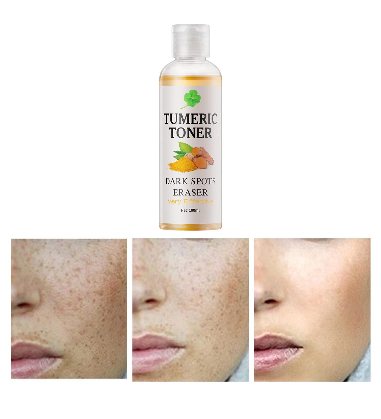 Turmeric Dark Spot Corrector Toner 4oz - Facial Toner for Acne Prone Skin - Hydrating Dark Spot Remover for Women - Hyperpigmentation Treatment for Dry Oily Skin - Buy Online on SooperMarket.com