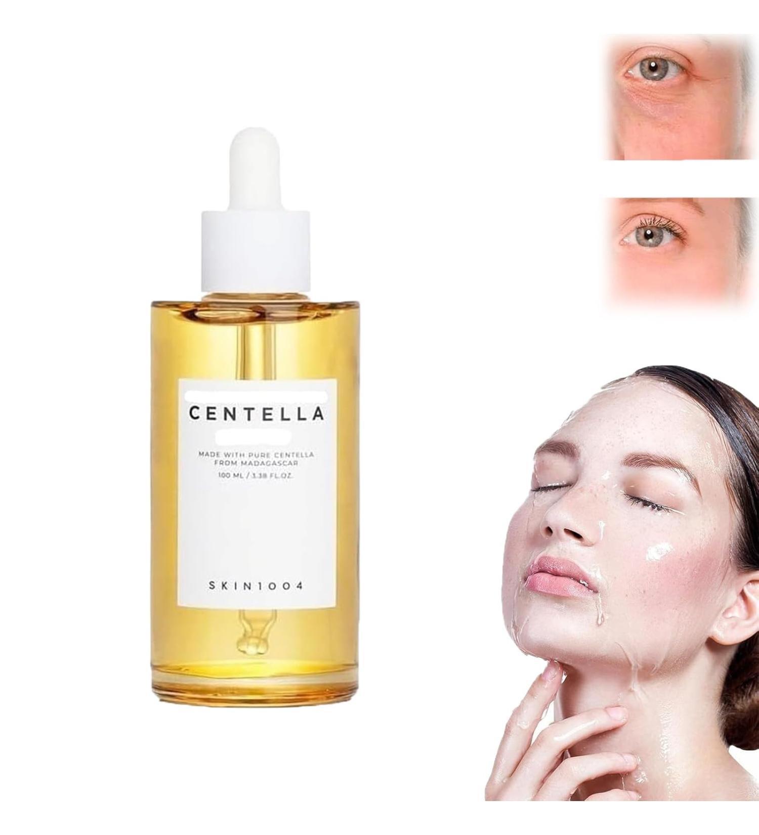 Centella Asiatica Face Serum Centella Serum for Face Recovery Face Serum for Acne Pore Skin Sensitive Oily Dry Skin Soothing Hydrating Serum for Women 100ml - Buy Online on SooperMarket.com