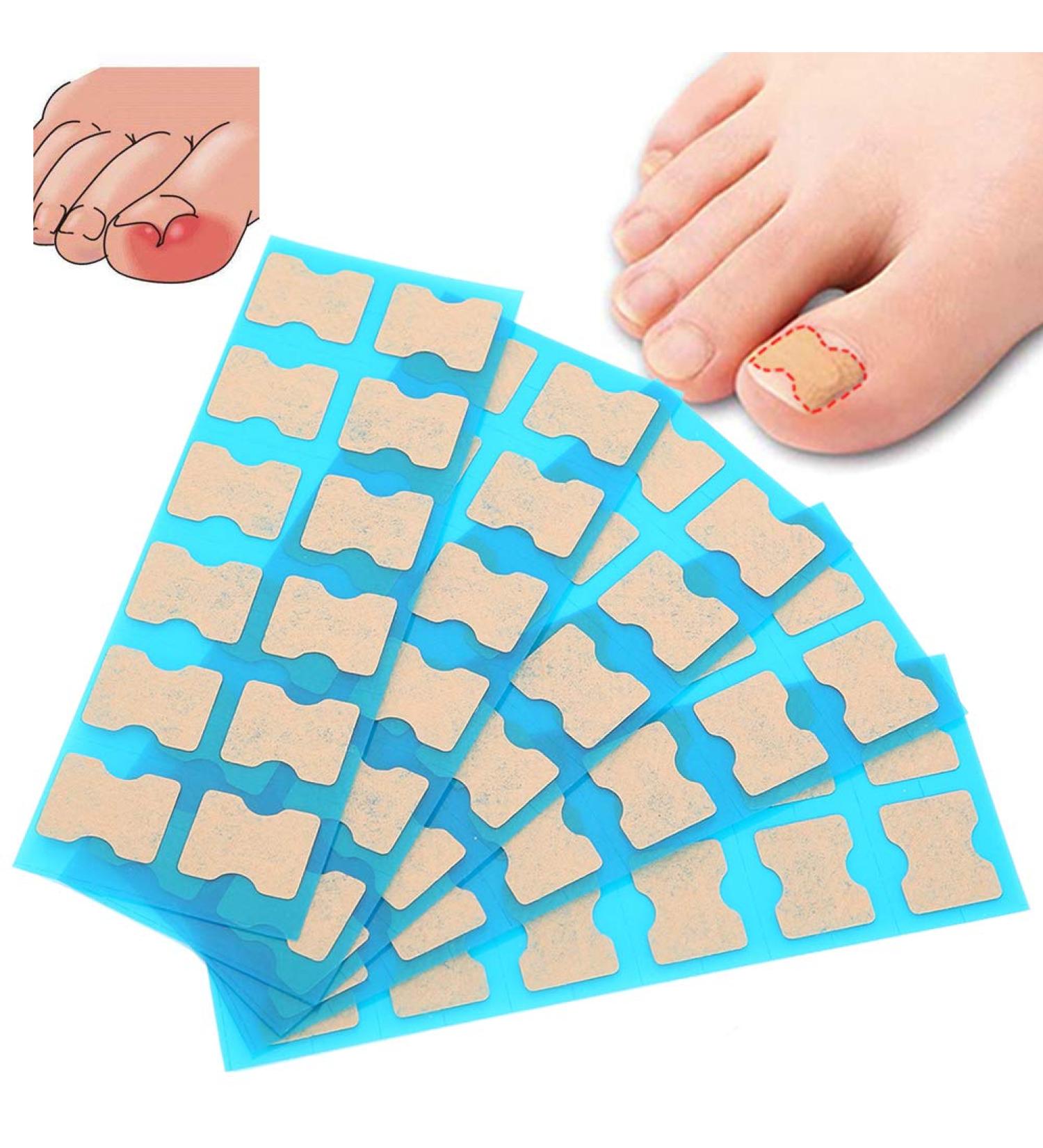 Ingrown Toenail Correction Foot Care Pedicure Sticker Corrector Ingrown Patch Relief Toe Patch Treatment Tool60pcs (60 Pieces) - Buy Online on SooperMarket.com