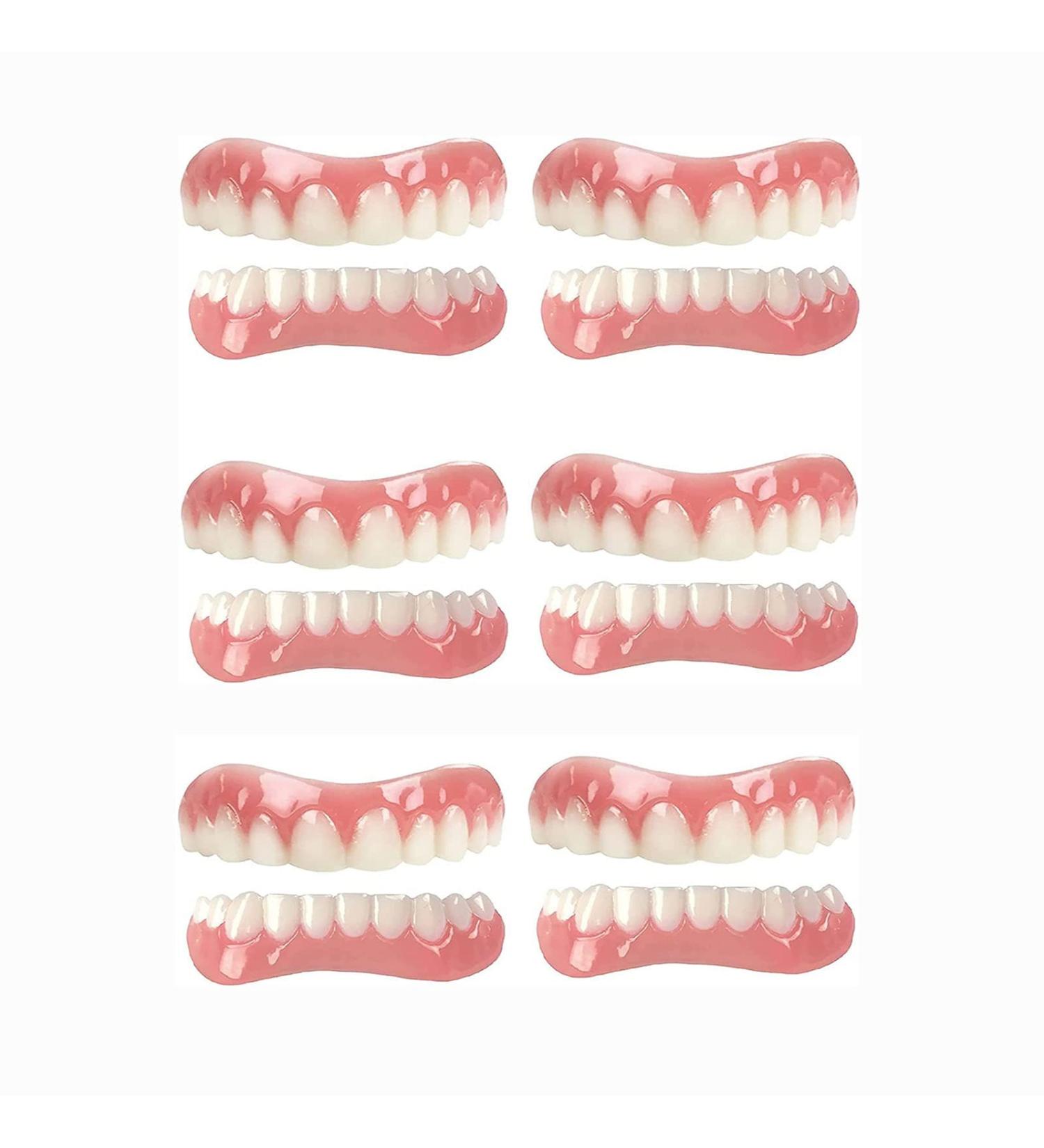 CAILING Snap On Veneers for Missing Teeth - 6 Sets Instant Denture Filling Kit - Fake Braces for Realistic Looking Teeth - Buy Online on SooperMarket.com