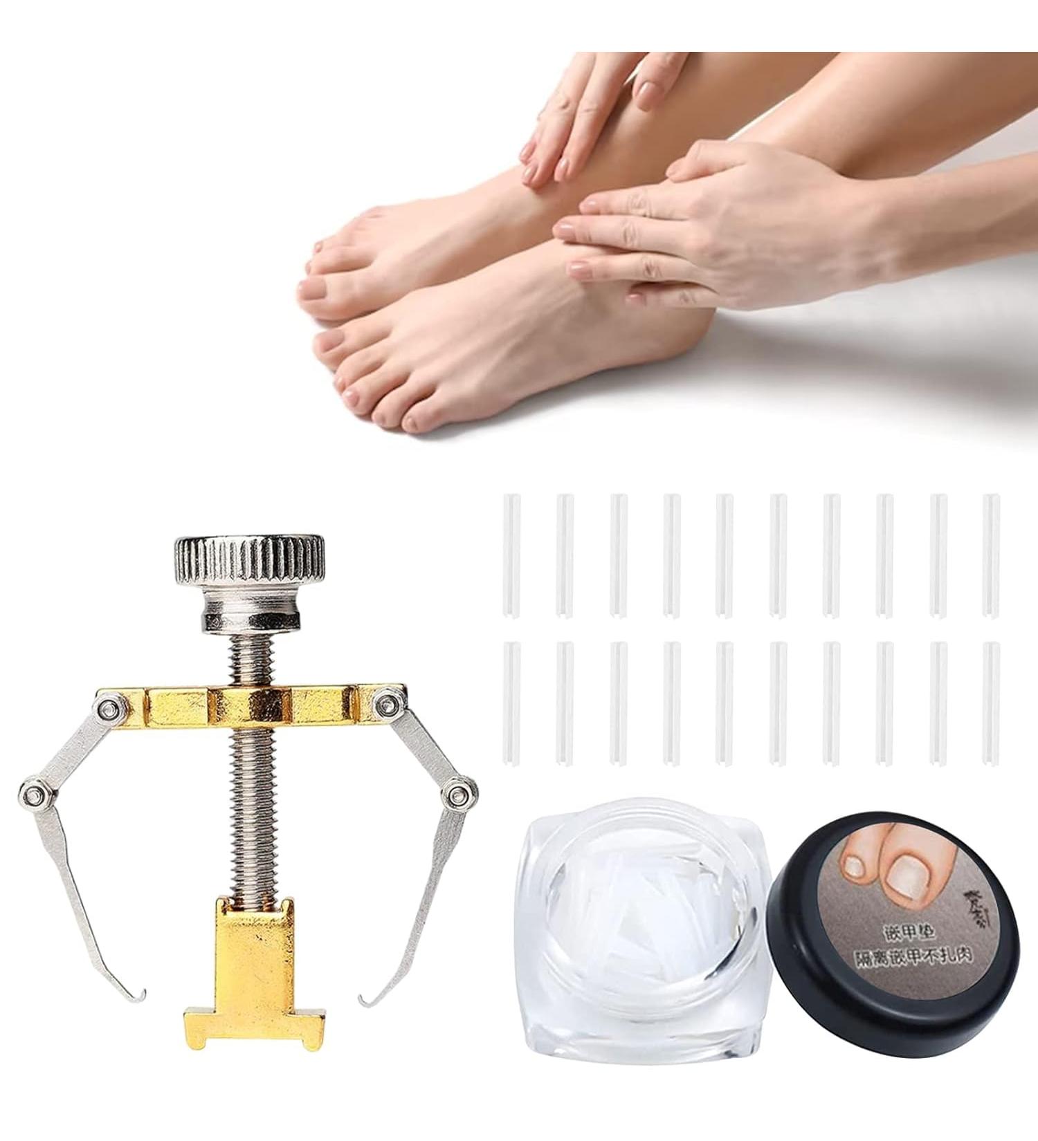 Ingrown Toenails Set Toenail Correction Toenail Toenail Patch Ingrown Toenails Tool Set Toenail Corrector Pedicure Tools Correction Sticker Toe Nails 21 Pieces - Buy Online on SooperMarket.com