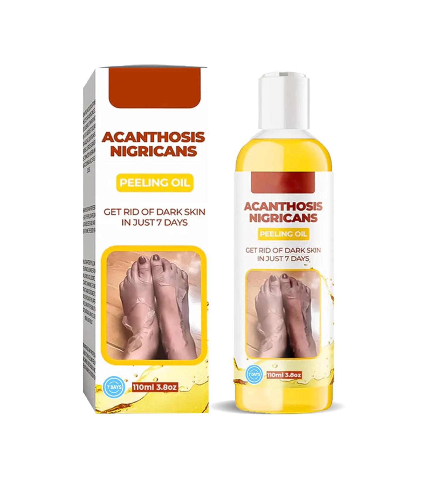 Extra Strong Peeling Oil - Chemical Exfoliant for Face & Body | Reduces Wrinkles Stretch Marks & Dead Skin - Buy Online on SooperMarket.com