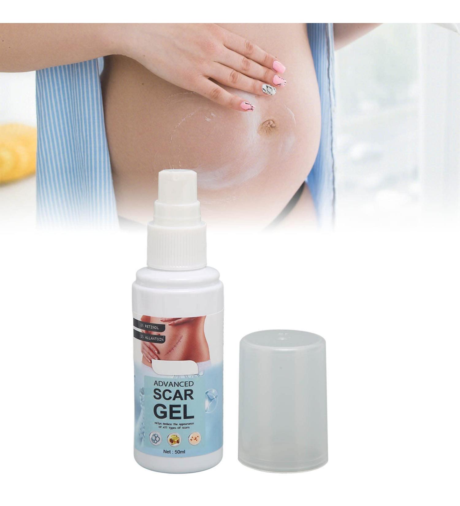 Stretch Mark Gel 2Pcs 50ml with Allantoin & Vitamin E - Hydrating Scar Remover for Scars, Burns & Surgery - Buy Online on SooperMarket.com