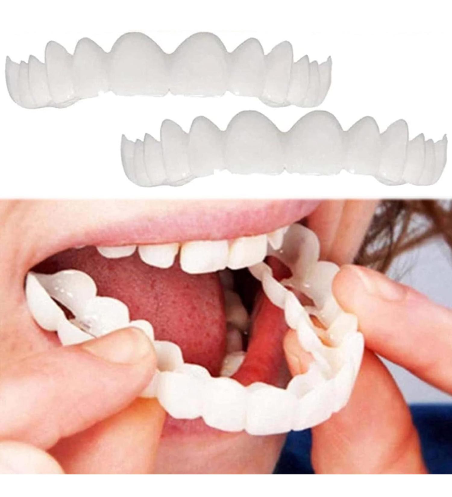 Risely Temporary Whitening Veneers - 2 Pairs of Artificial Teeth for Men & Women | Plug-In Braces & Lightening Dentures - Buy Online on SooperMarket.com