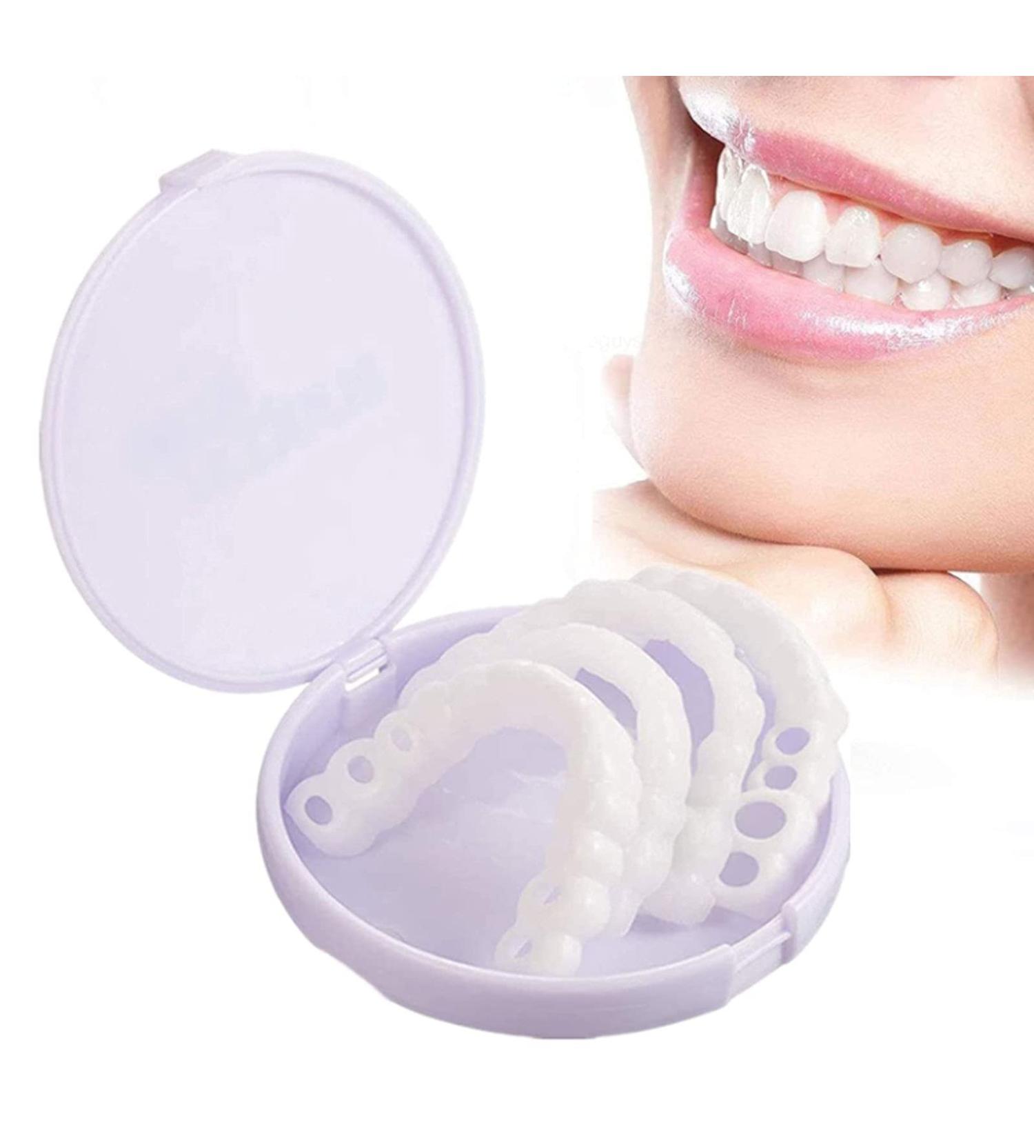 icehao Upper & Lower Teeth Veneers - Simulation Braces Snap On Smile Tooth Cover for Perfect Whitening - One Size Fits Most Comfortable Denture - 2pcs Set - Buy Online on SooperMarket.com