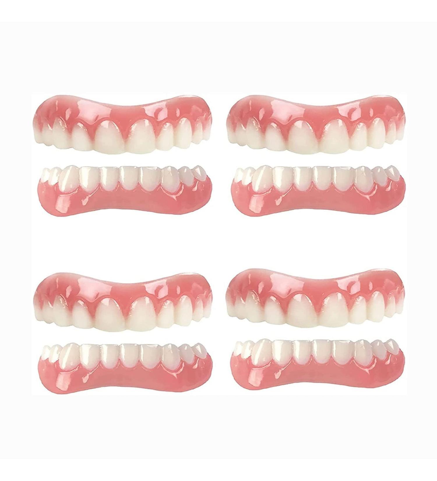 Cailong Instant Veneers & Whitening Kit - 4 Pairs for Snap-On Temporary Tooth Covering & Filling - Sensitive Teeth Friendly - Buy Online on SooperMarket.com