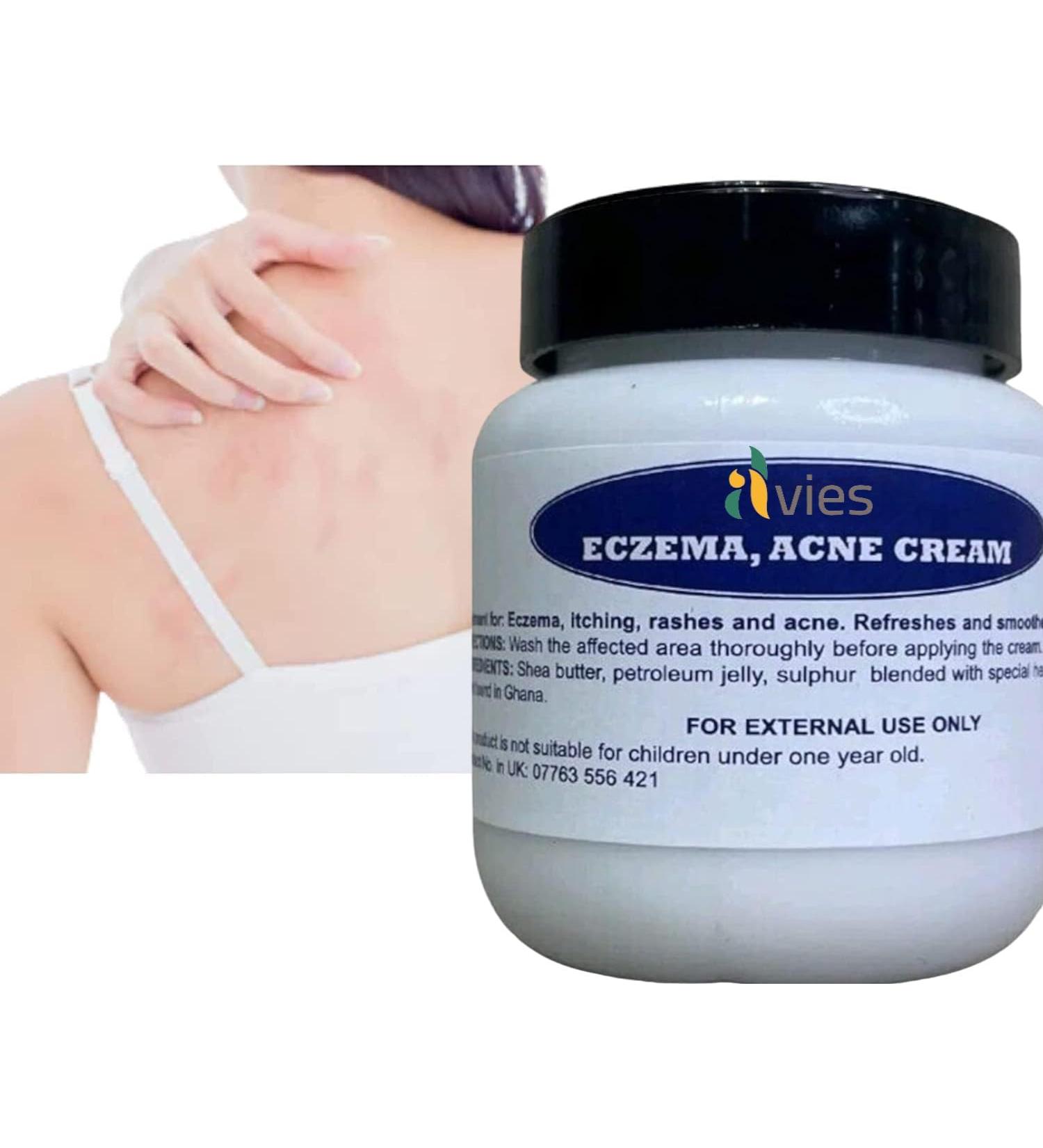 Alvies Abd Herbal Antibacterial Cream Anti-itch Relief