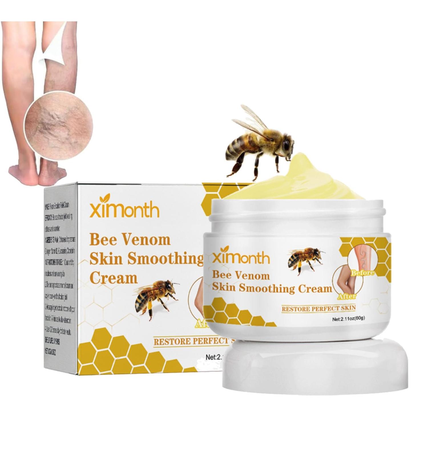 Furzero Bienengift Varicose Veins Cream - Best Spider Vein Relief & Pain Relief Salve (1 Piece) - Shop Internationally - Buy Online on SooperMarket.com