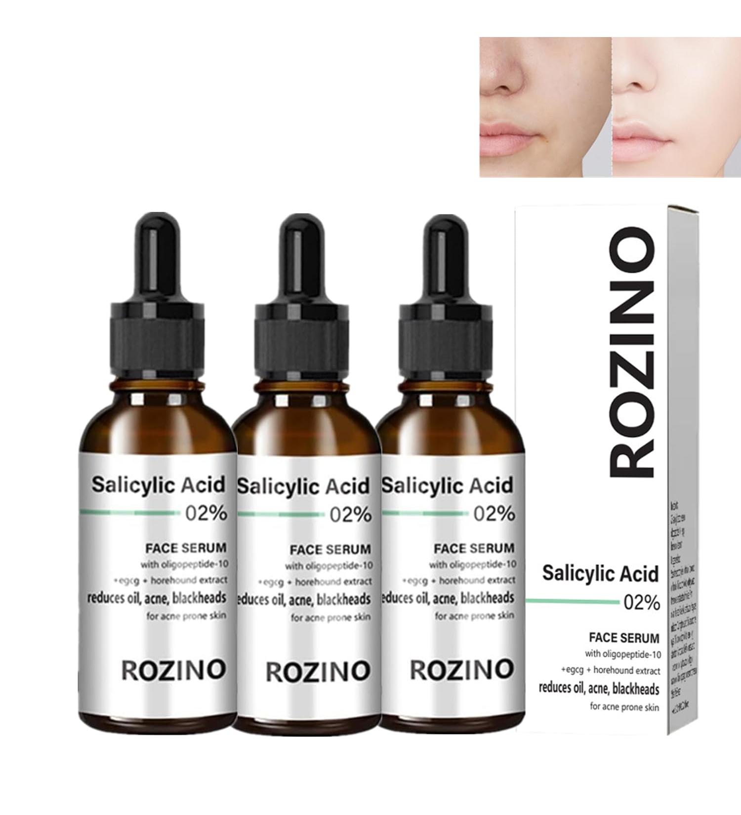 Rozino 3PC Face Serum Set | Advanced Collagen Boost Anti-Aging Solution for Glowing Skin - Buy Online on SooperMarket.com
