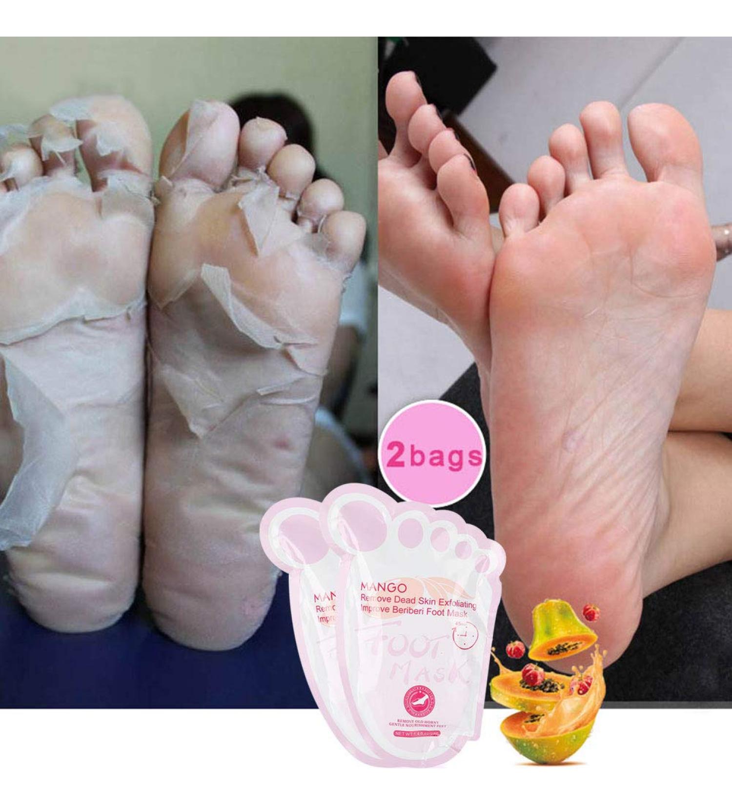 Mango Foot Peeling Mask - Exfoliating Foot Care for Soft Healthy Feet | 1 Pair Moisture Mask to Remove Dead Skin - Buy Online on SooperMarket.com