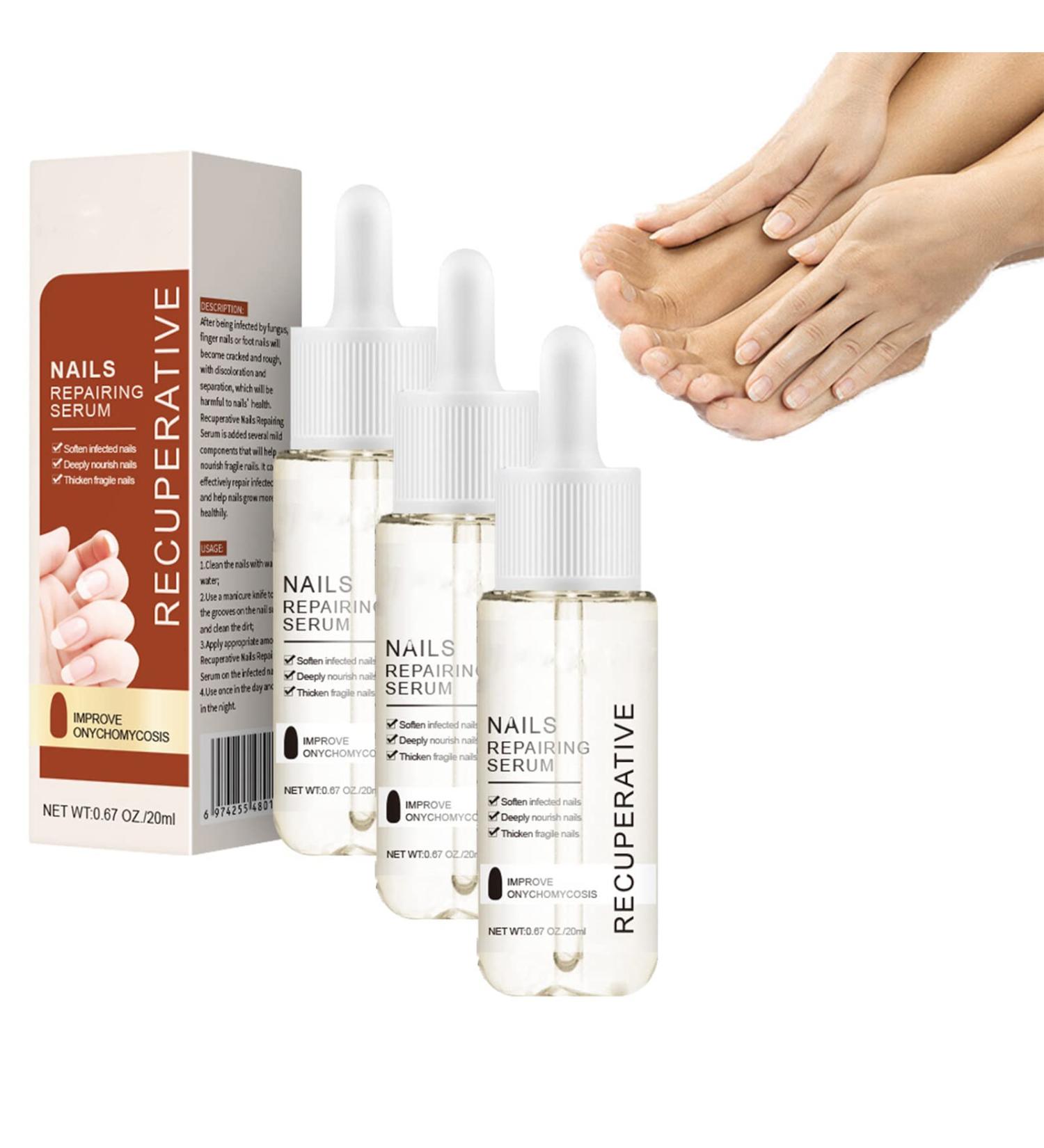 7 Days Nail Growth and Strengthening Serum 1/2/3/5 bottles Nail Strengthener and Growth Serum (3 bottles) - Buy Online on SooperMarket.com