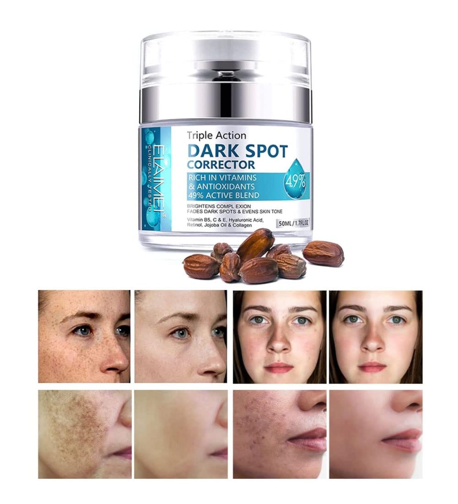 Fast-Acting Dark Spot Remover for Face & Body | Hyperpigmentation & Melasma Corrector | Even Skin Tone | Age Spot Treatment for Men & Women - Buy Online on SooperMarket.com