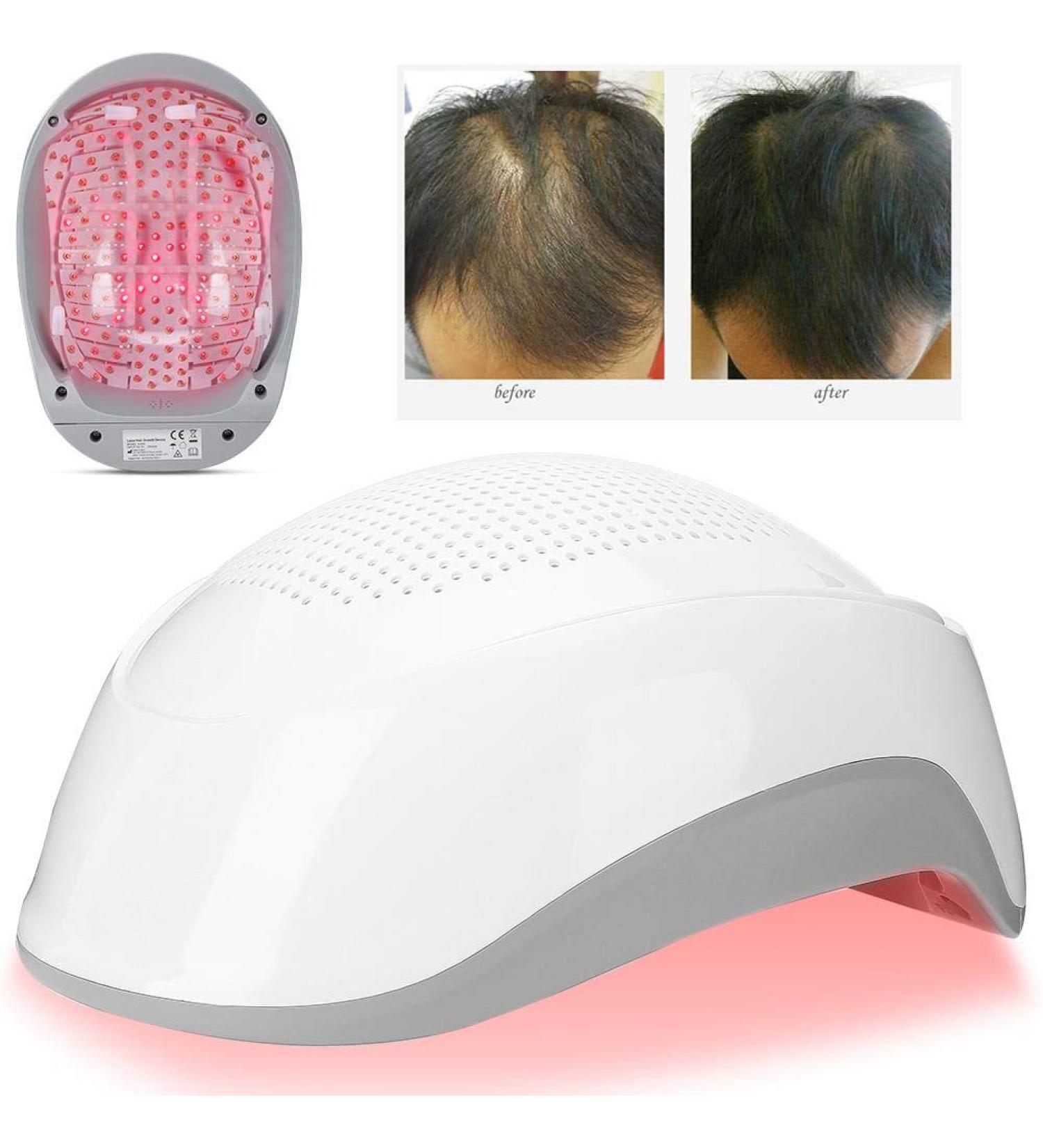 Laser Hair Growth Device - 180 Light Chips for Enhanced Hair Growth (Gray) | International Shipping Available - Buy Online on SooperMarket.com