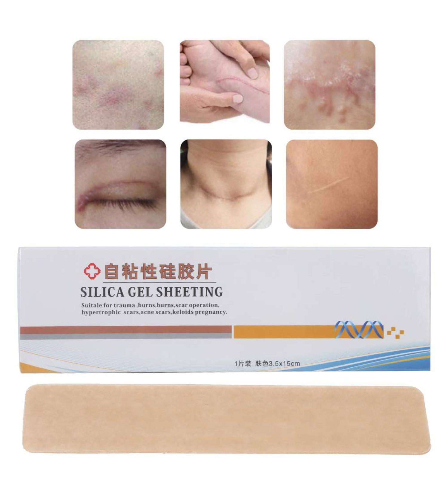 Silicone Scar Sheet - Self Adhesive, Portable & Durable for Wound Marks Removal - Ultra-Thin Concealer Surgery Burn Scar Sticker for All Skin Types - Buy Online on SooperMarket.com