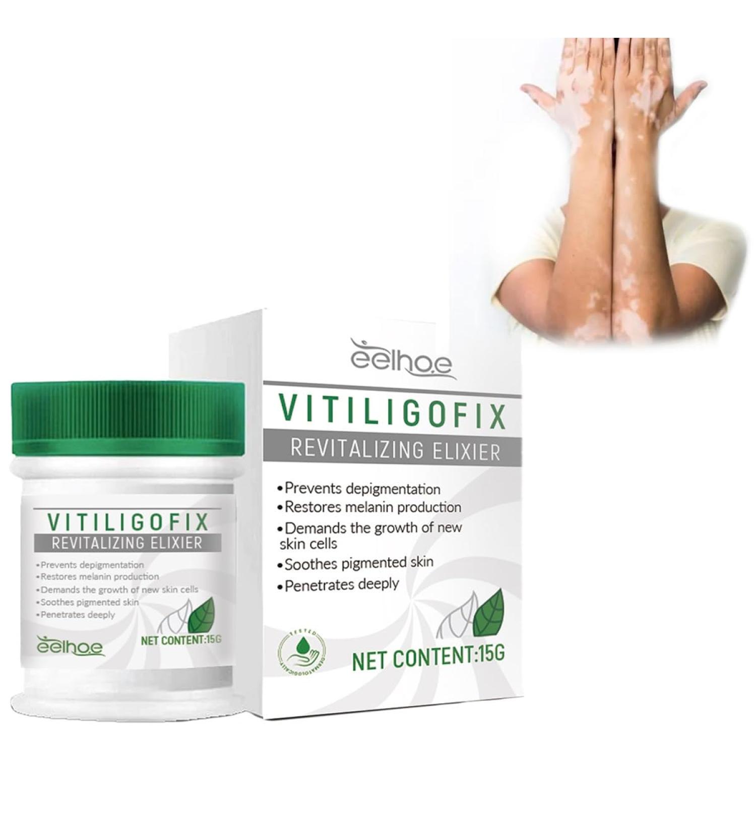 Vitiligo Treatment Cream | Natural White Spot Remover | Leukoplakia Relief | 2PCS - Buy Online on SooperMarket.com