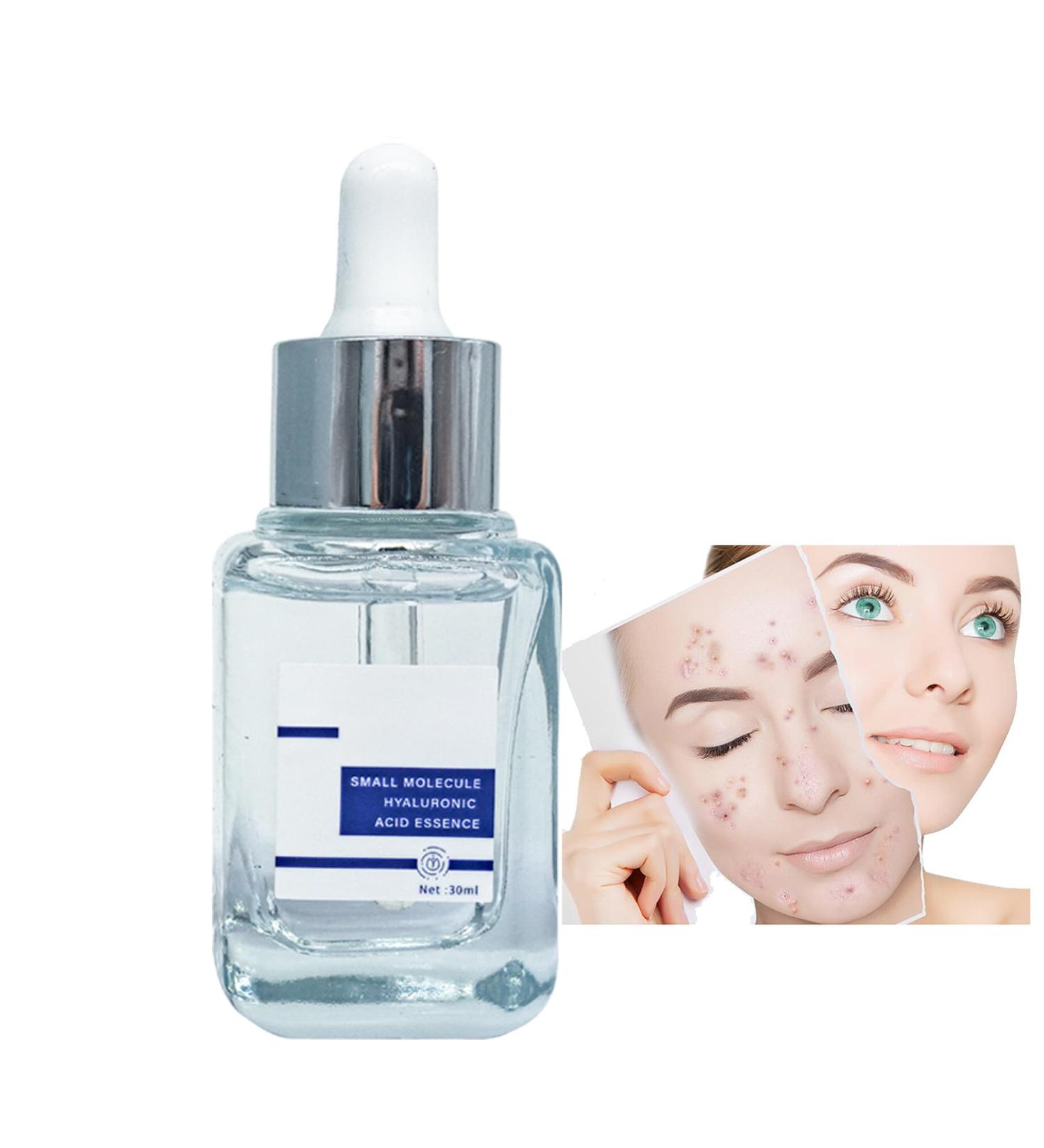 Face Serum Hyaluronic Acid Serum Skincare Serum Hyaluronic Acid Collagen Serum For Face Face Serum For Women & Men To Plump And Smooth Skin All Skin Types Skin Care. - Buy Online on SooperMarket.com