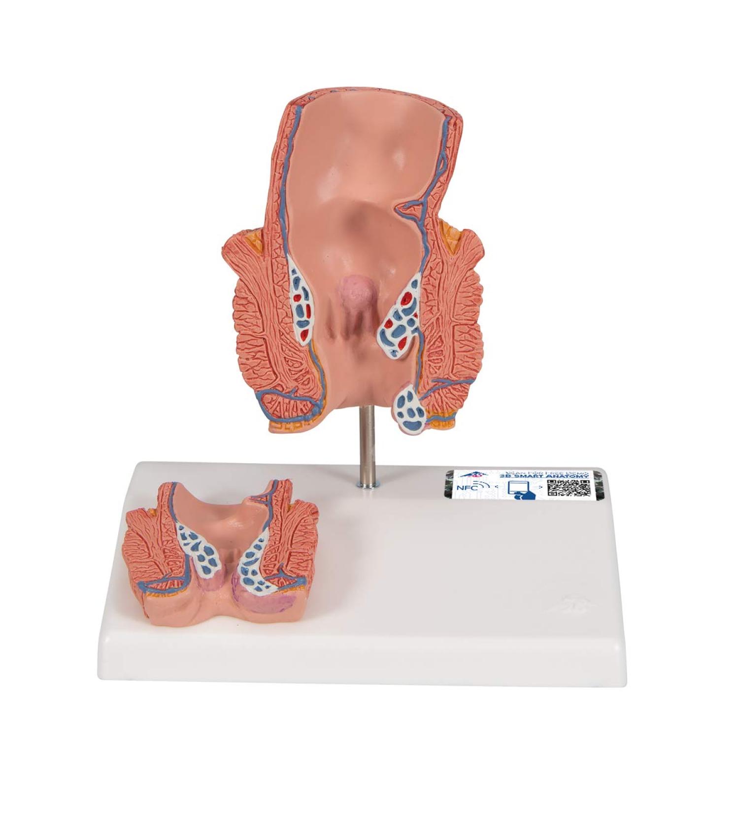 3B Scientific K27 Hemorrhoid Model 5.5-Inchx3.9-Inchx5.5-Inch - Buy Online on SooperMarket.com