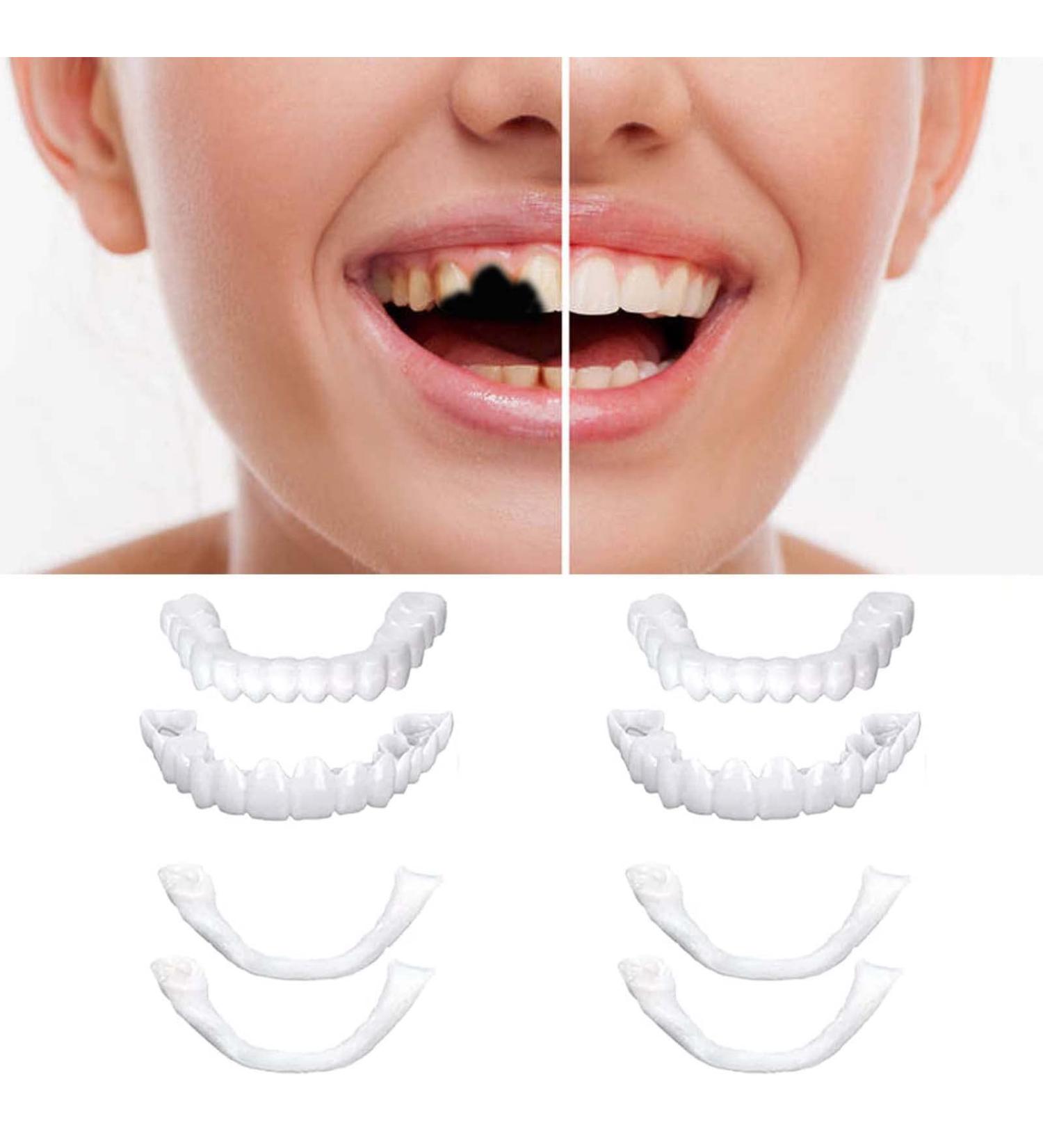 2 Pairs Veneers Dentures - Temporary Tooth Repair for Imperfect Teeth - Buy Online on SooperMarket.com
