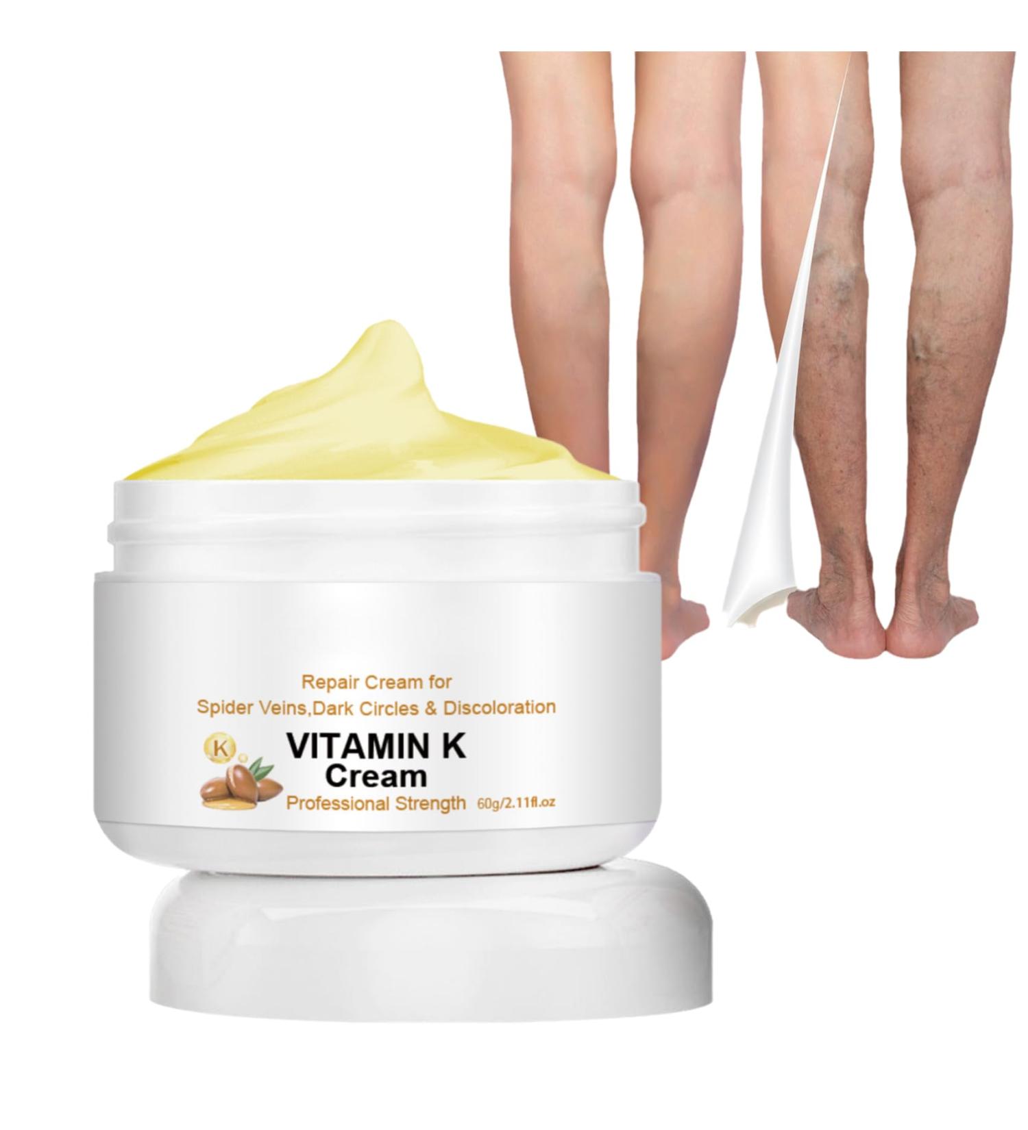 Vitamin K Cream for Varicose Veins - Miracle Cream for Spider Veins & Leg Vein Removal (1pcs) - Fast International Shipping - Buy Online on SooperMarket.com