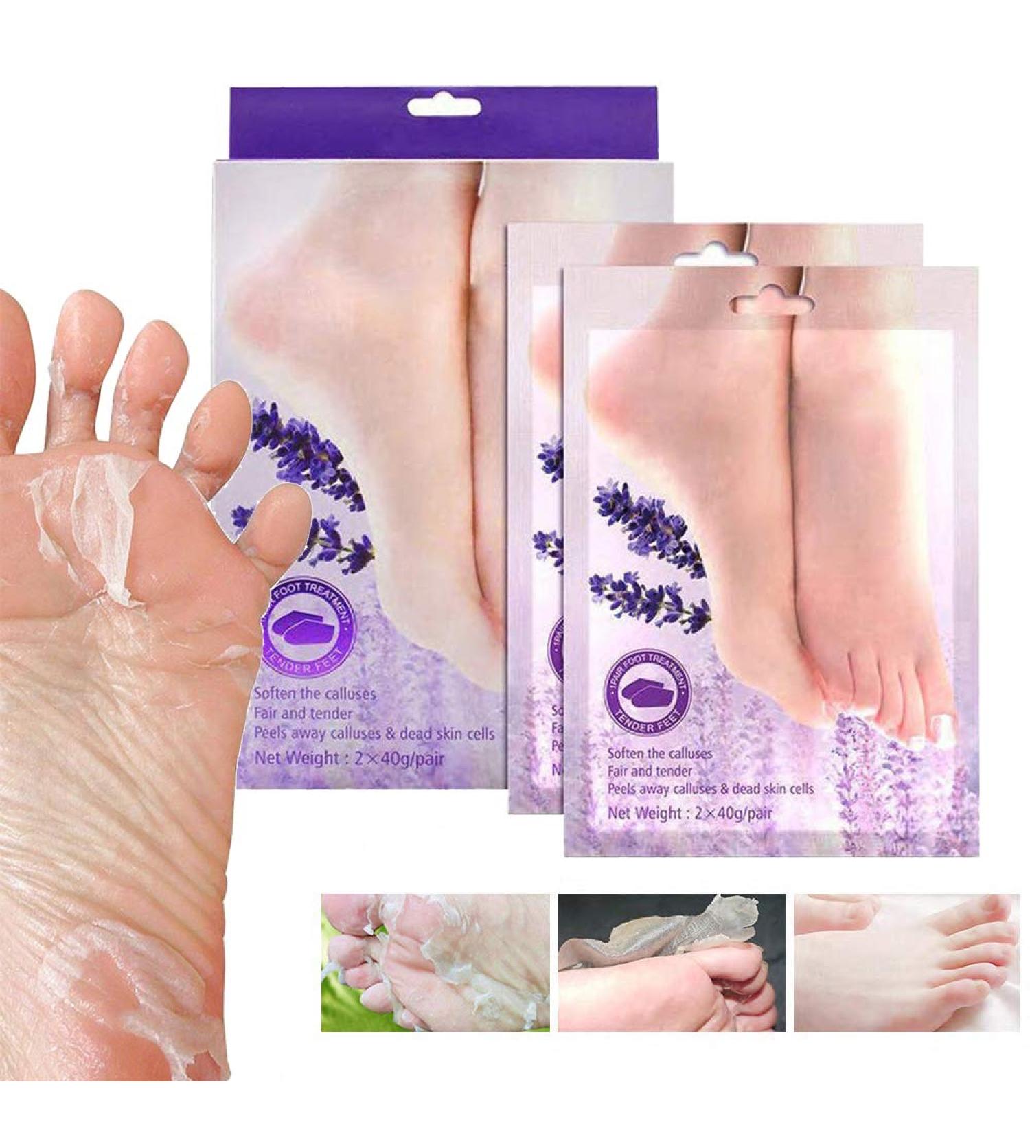 Exfoliating Foot Peel Mask - 2 Pairs | Remove Dead Skin in 3-7 Days | Lavender Scented Foot Mask for Soft Feet - Buy Online on SooperMarket.com