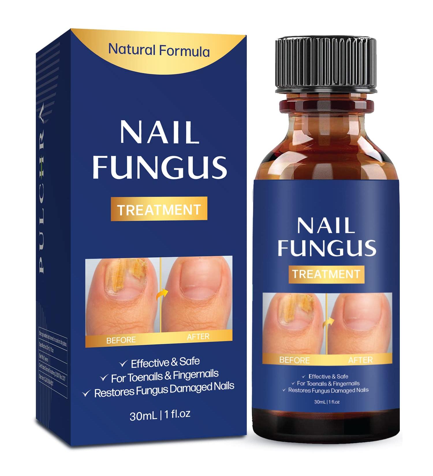Extra Strength Toe Nail Fungus Treatment - Effective Nail Repair Solution for Healthy Nails - Buy Online on SooperMarket.com