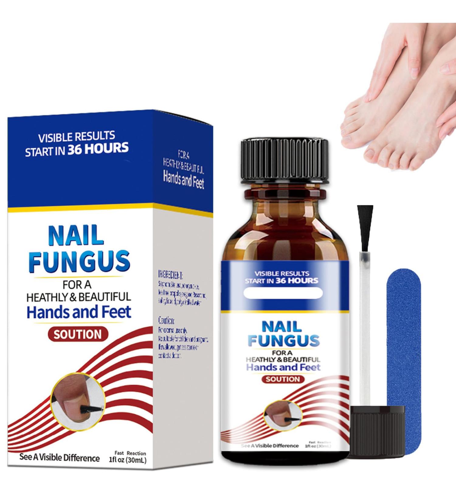 Fungal Nail Treatment For Toenails - Extra Strong Nail Fungus Treatment for Toenail - Toe Nail Fungal Treatment - Anti-Fungal Nail Repair Treatment with Nail File and Nail Brush - Buy Online on SooperMarket.com