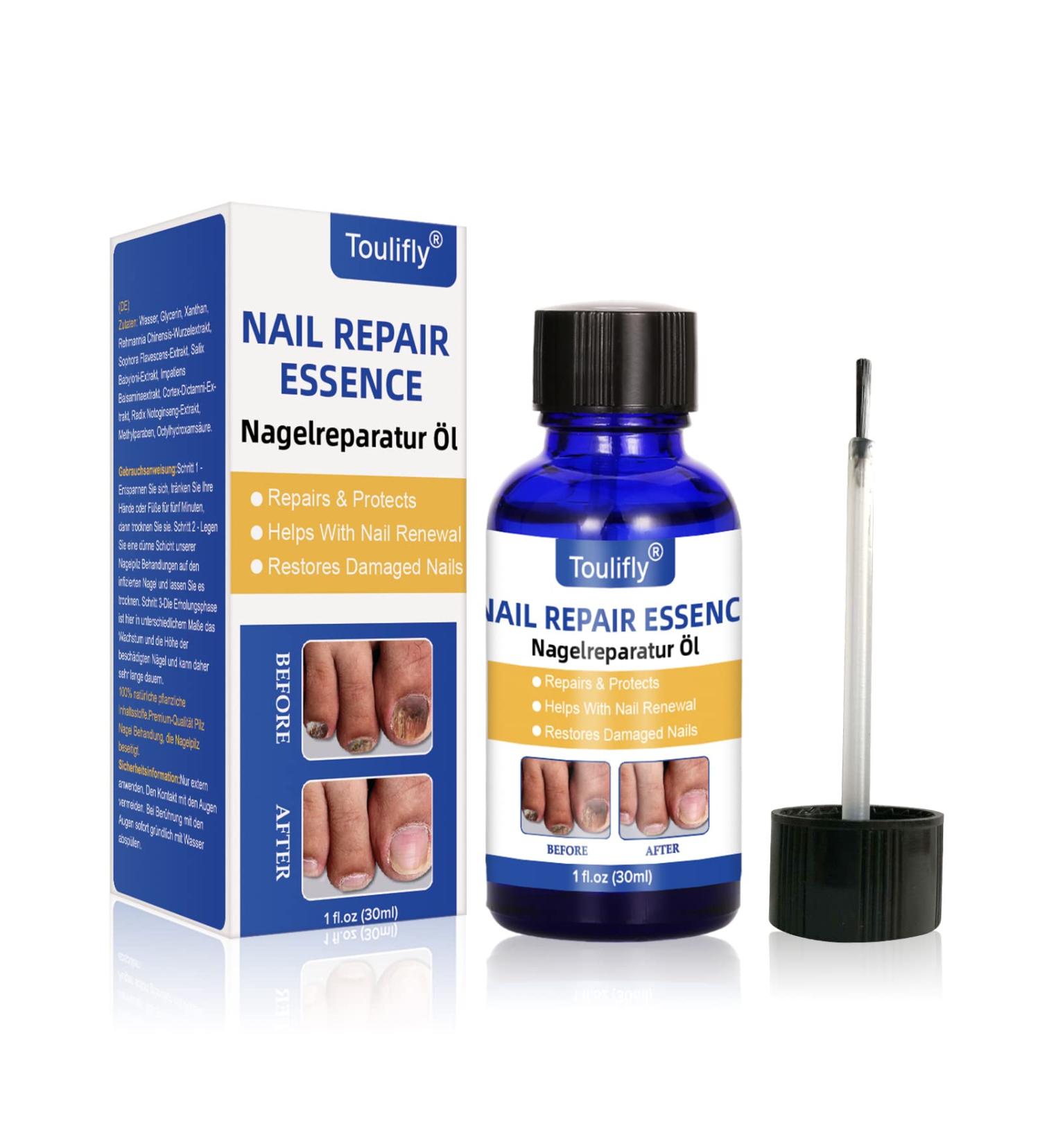 Premium Nail Care & Treatment | Repair Broken & Discolored Nails with Nourishing Nail Oil & Serum for Healthy Hands & Feet - Buy Online on SooperMarket.com