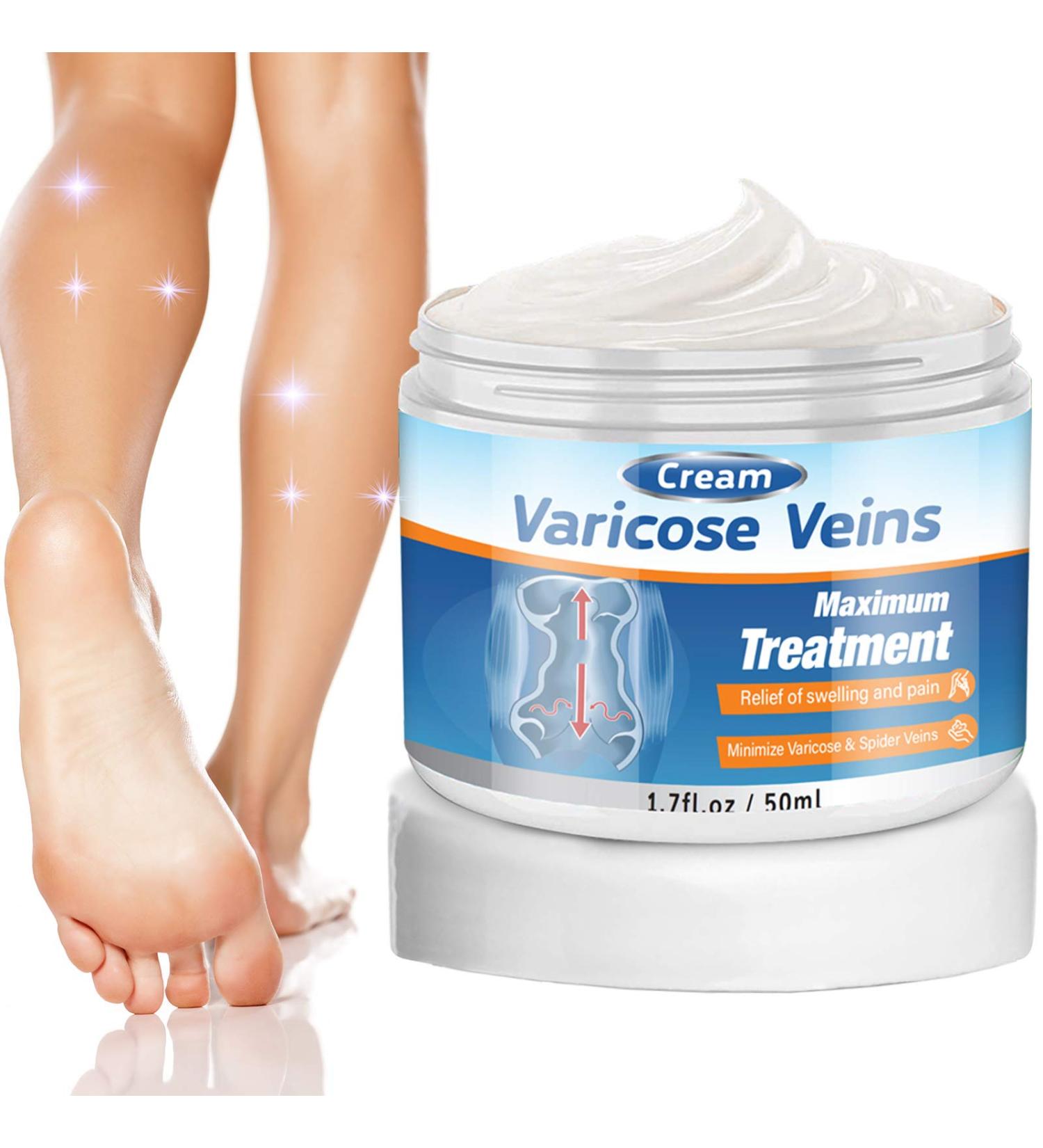 Varicose Veins Cream - Effective Treatment for Leg Relief, Phlebitis & Circulation Improvement (1.7 Fl Oz) - Buy Online on SooperMarket.com