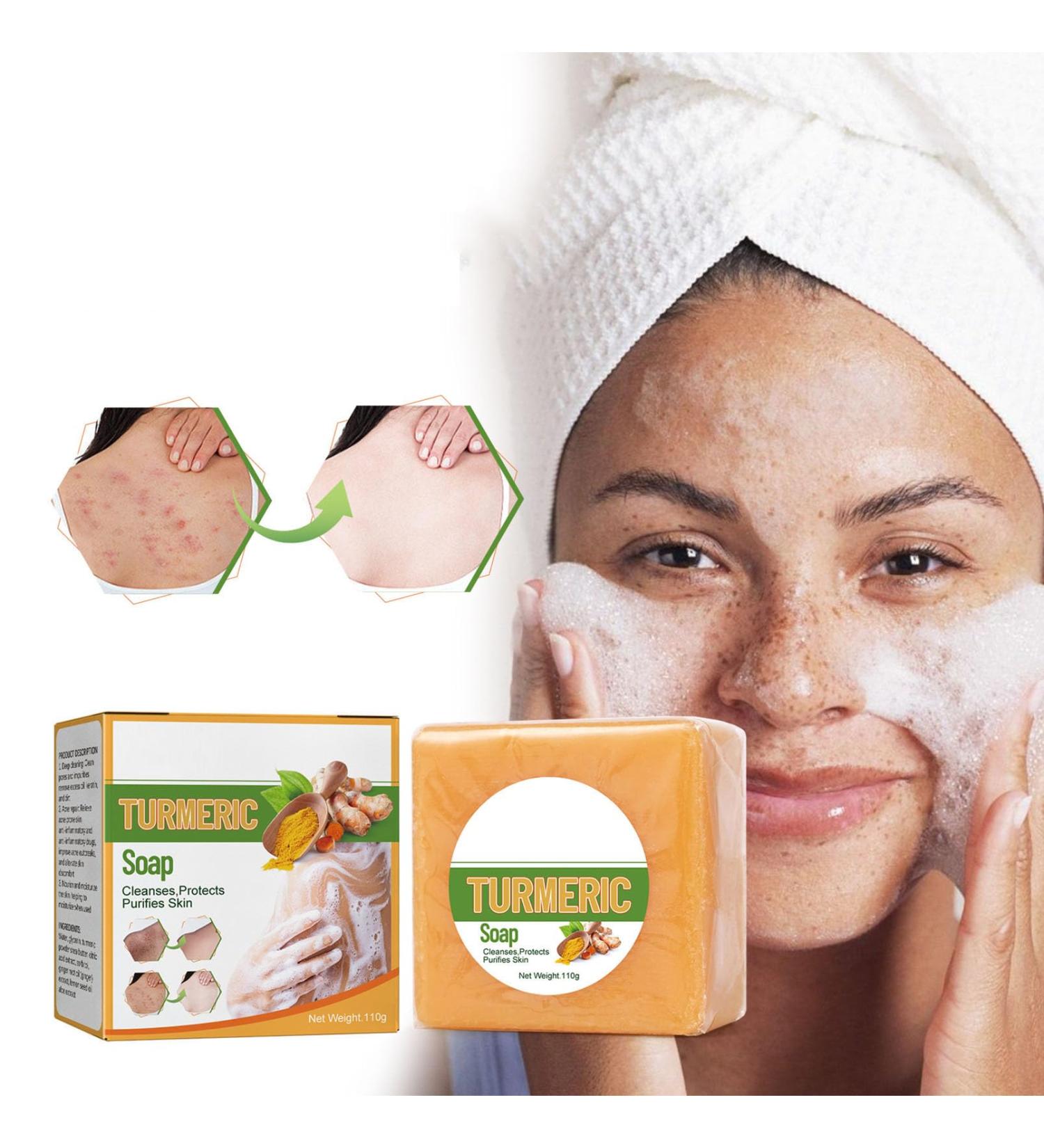 Nmbol Skin Turmeric Soap Cojic Acid Soap For Skin Lightening Kurkuma Soap Lightening Solid Facial Soap Handmade Organic Natural Soap Soap For Dark Spots Hyperpigmentation Smooth Skin - Buy Online on SooperMarket.com