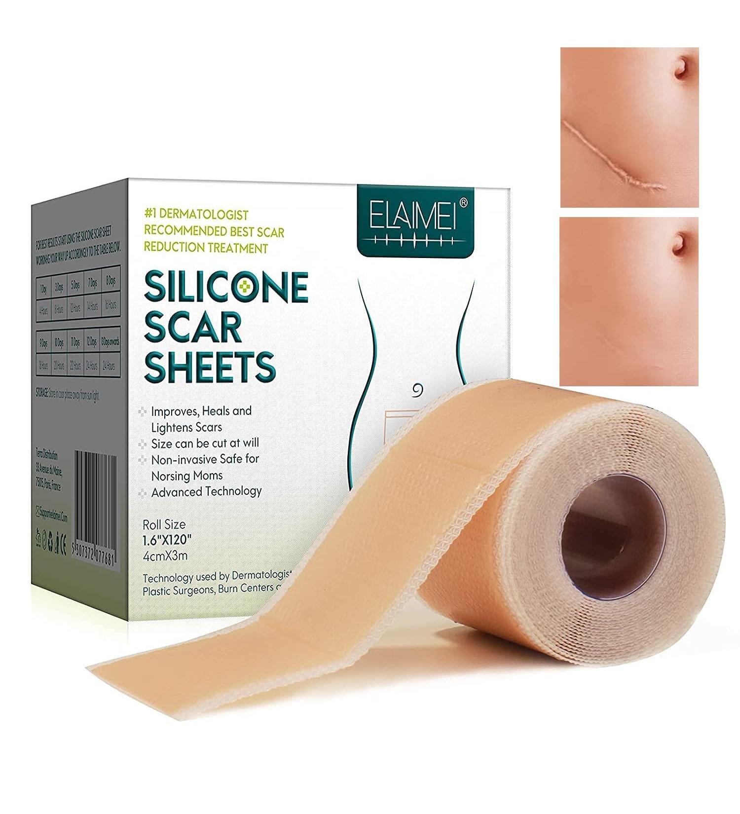 Soft Silicone Scar Tape Roll 1.6x 120 (8 Month Supply) | Reusable & Effective Scar Removal for C-Section, Keloid Surgery, Burn & Acne - Buy Online on SooperMarket.com