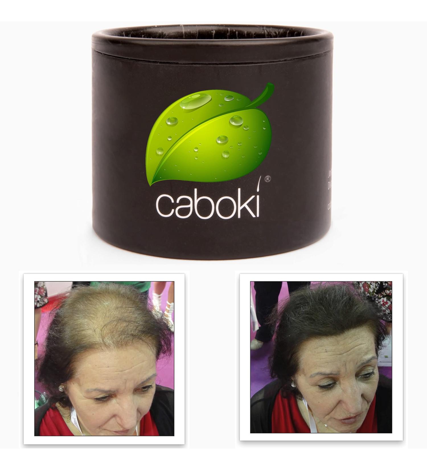 Dark Brown Hair Loss Concealer Trial Size - Cover Bald Spots Instantly - 10-Day Supply - All-Natural Fiber Formula - Buy Online on SooperMarket.com
